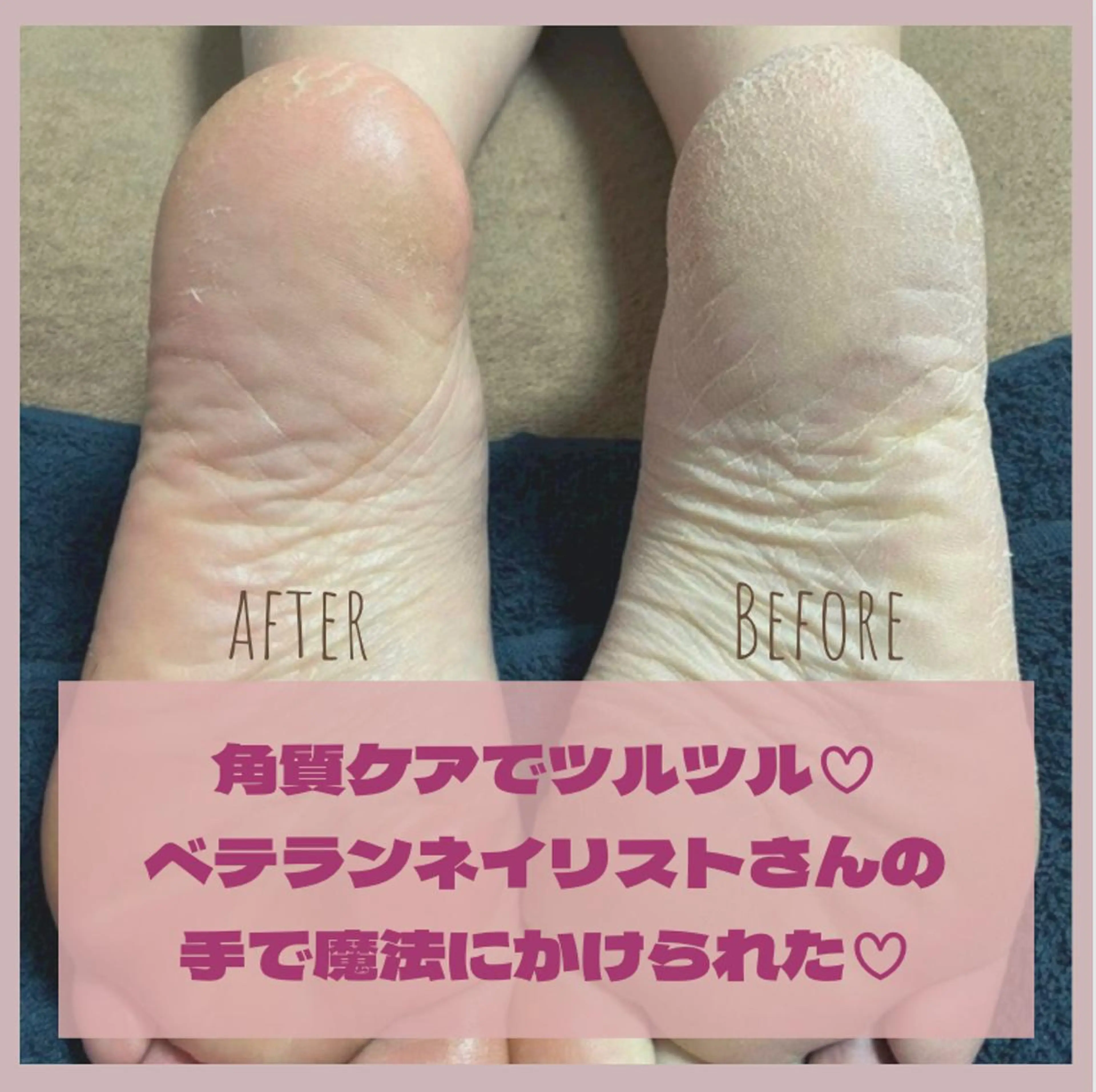 ネイル LOKA-HULU  ロカフルのマツエク・マツパデザイン