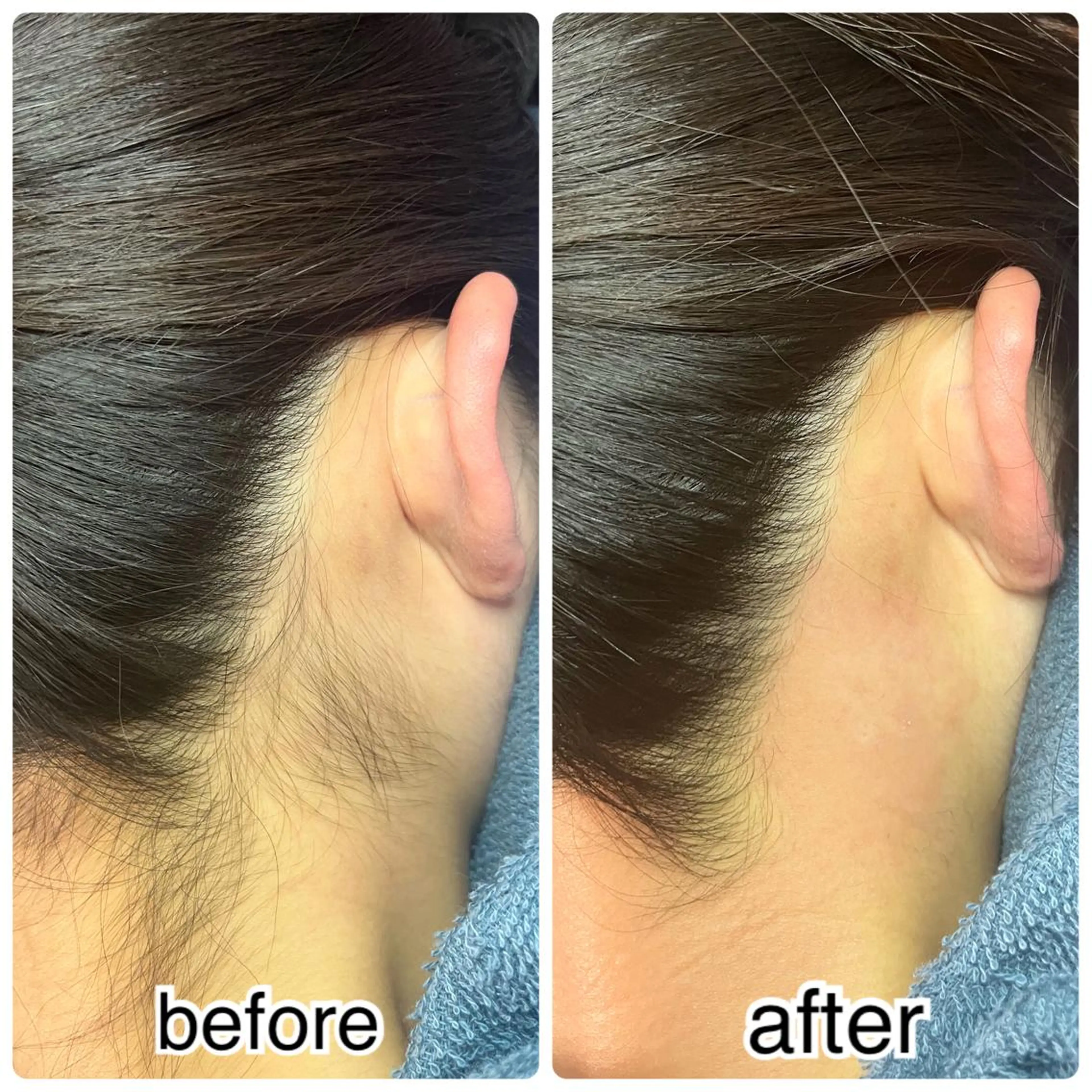 脱毛 total beauty salon R's所属・totalsalon R.sの眉毛・アイブロウイメージ