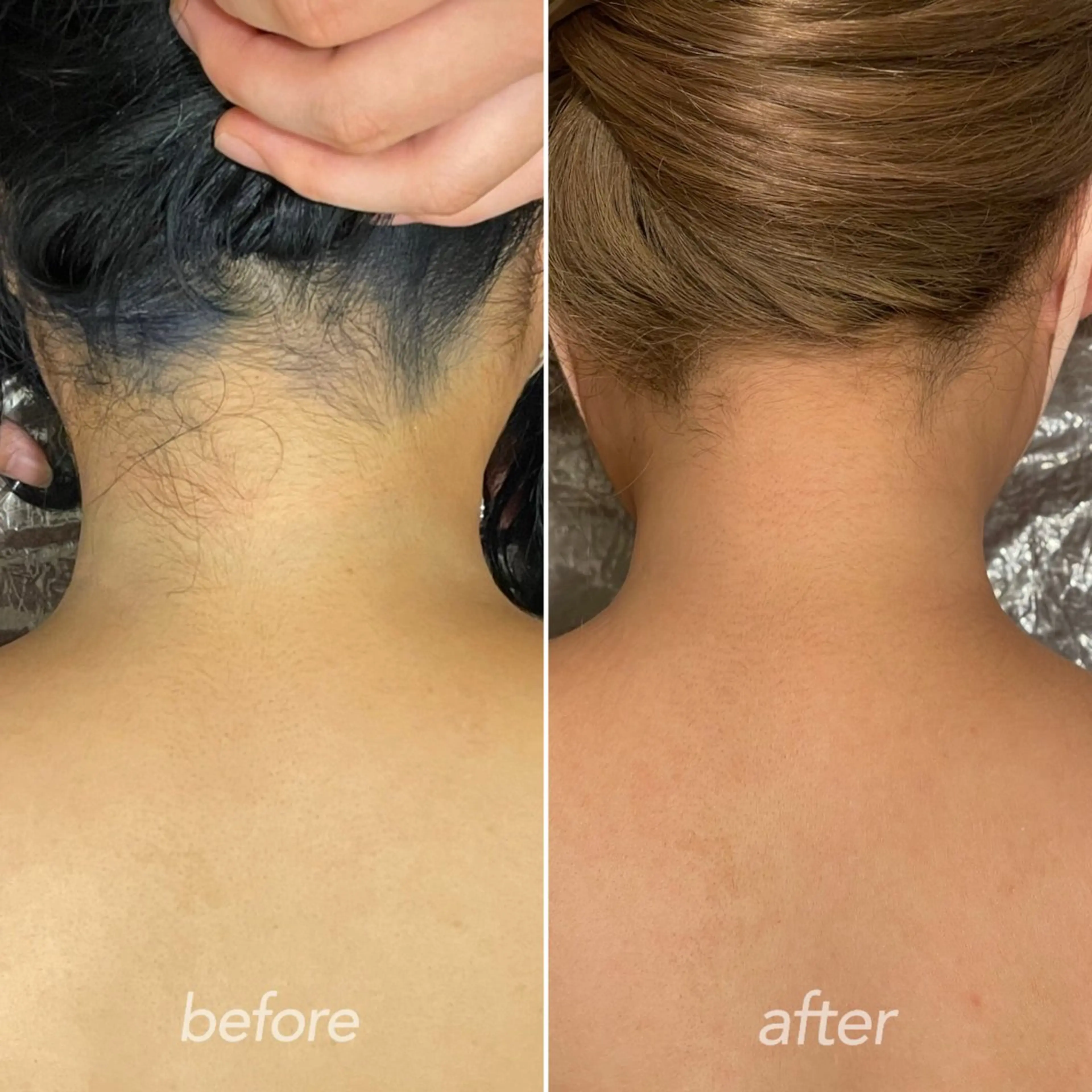 脱毛 越野 Tulipe栄店のエステ・リラクイメージ