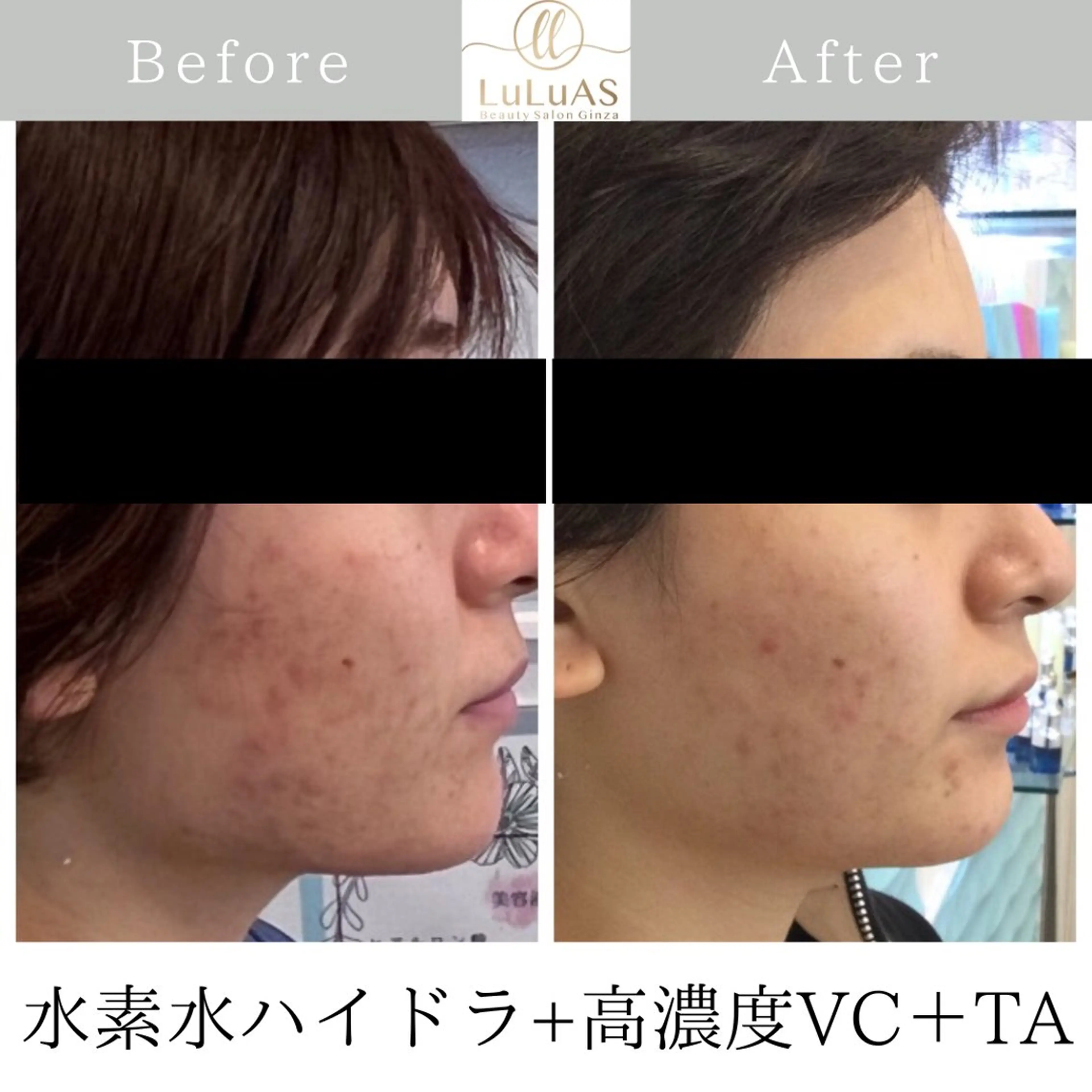 エステ リラク ルルアス GINZAのエステ・リラクイメージ