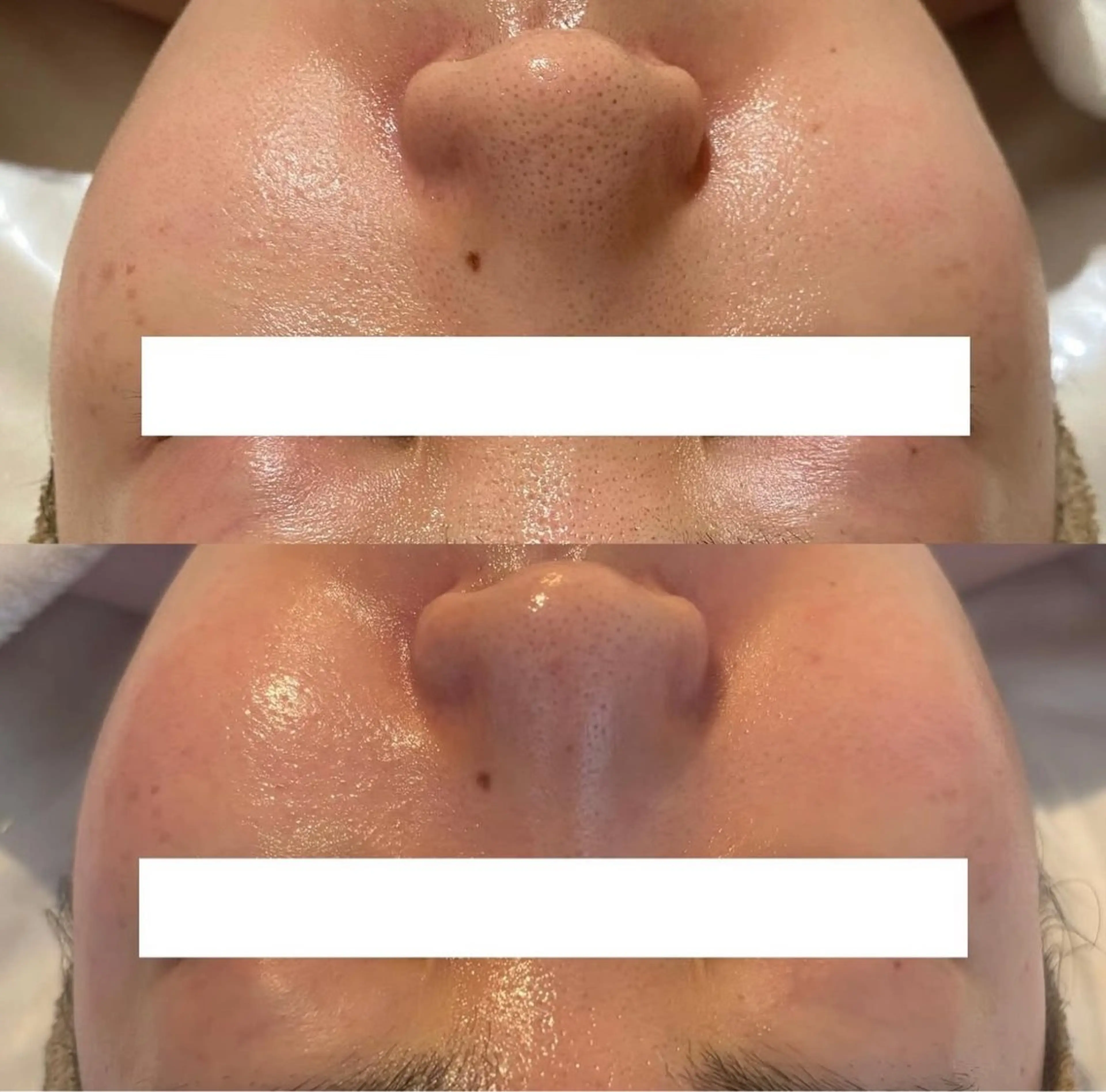 中目黒ハーブピーリン グ🌿ララピールのエステ・リラクイメージ