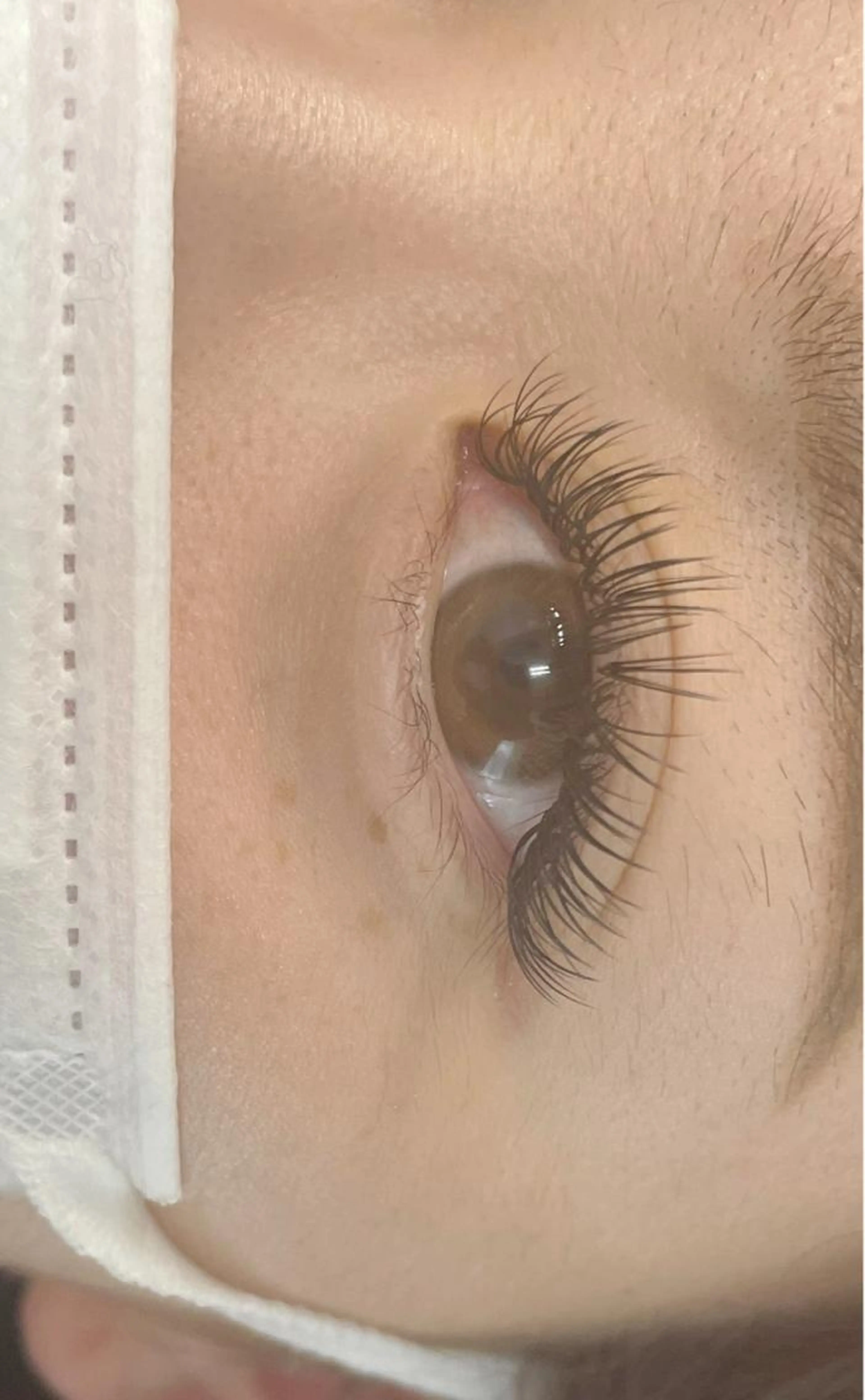 バインドロック100束の写真