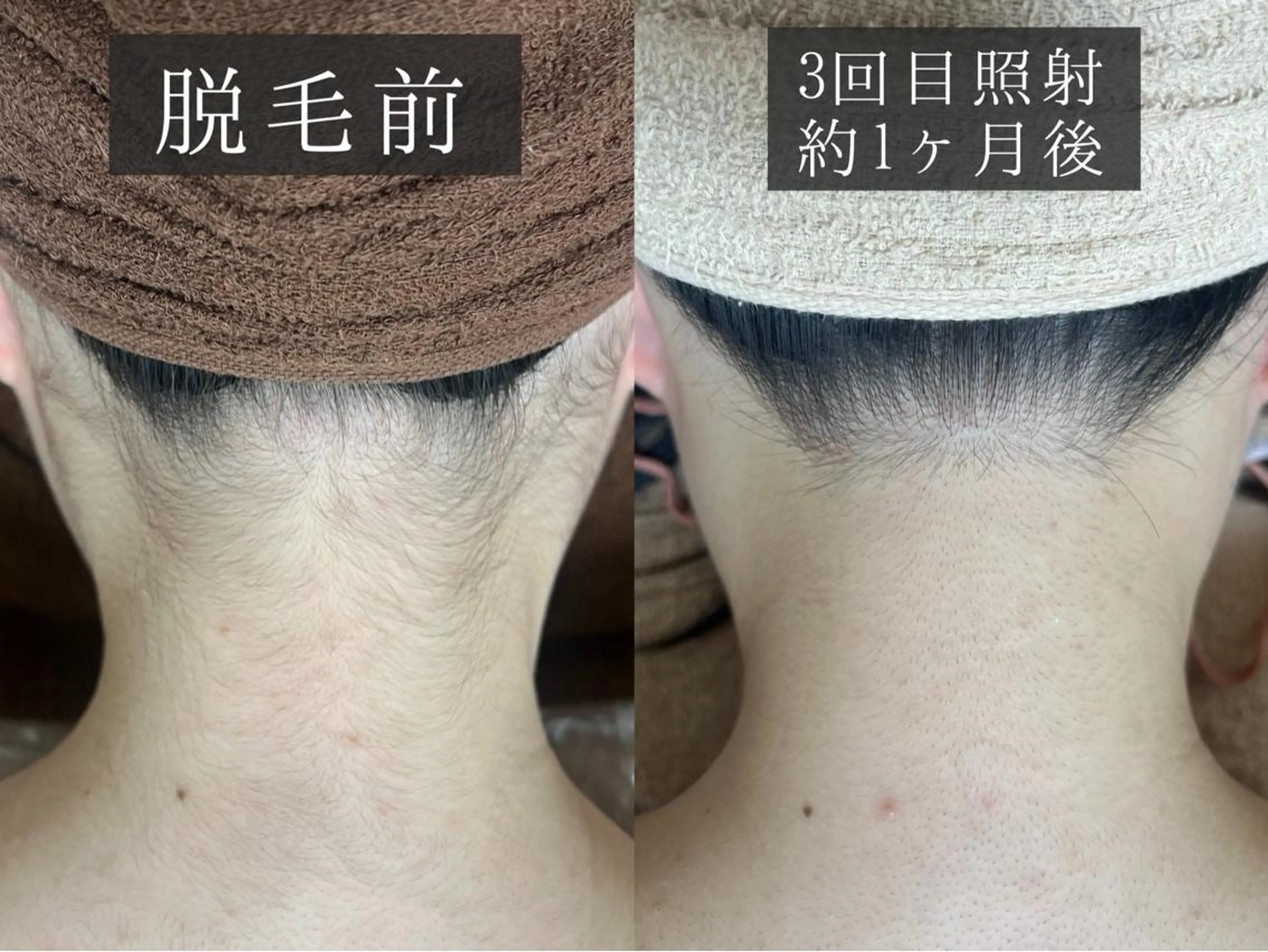 脱毛 脱毛専門サロン BELFINE恵比寿のエステ・リラクイメージ