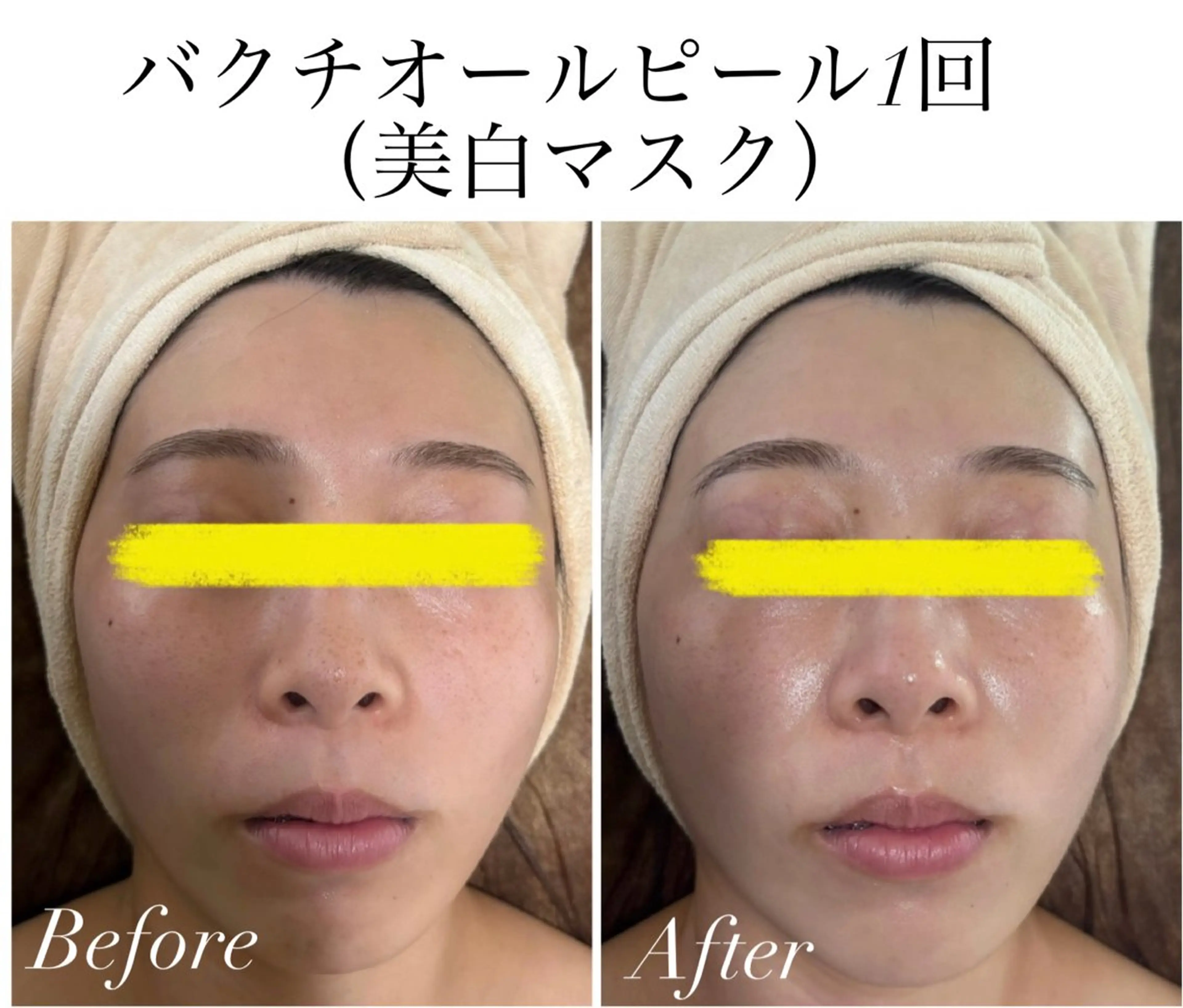 エステ リラク 《美肌&小顔サロン》 Masqueradeのエステ・リラクイメージ