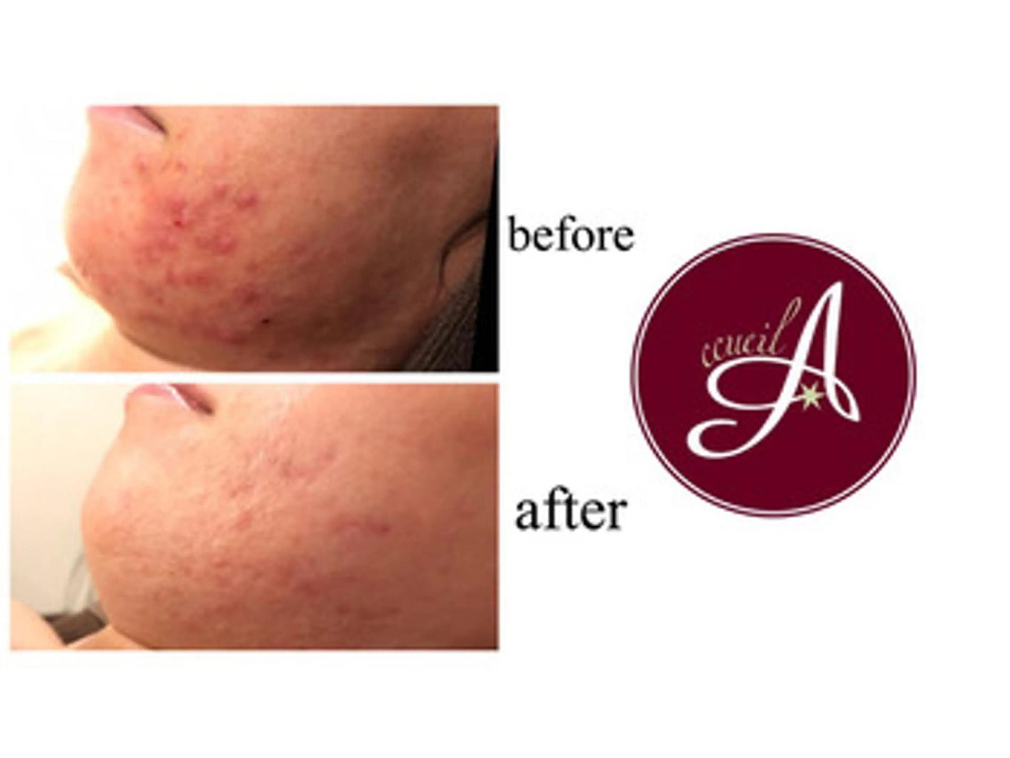 ミディアム カラー パーマ ヘアアレンジ メンズ キッズ ネイル マツエク・マツパ エステ リラク ニキビ・肌質改善専門 ♡人生が変わるサロンのエステ・リラクイメージ