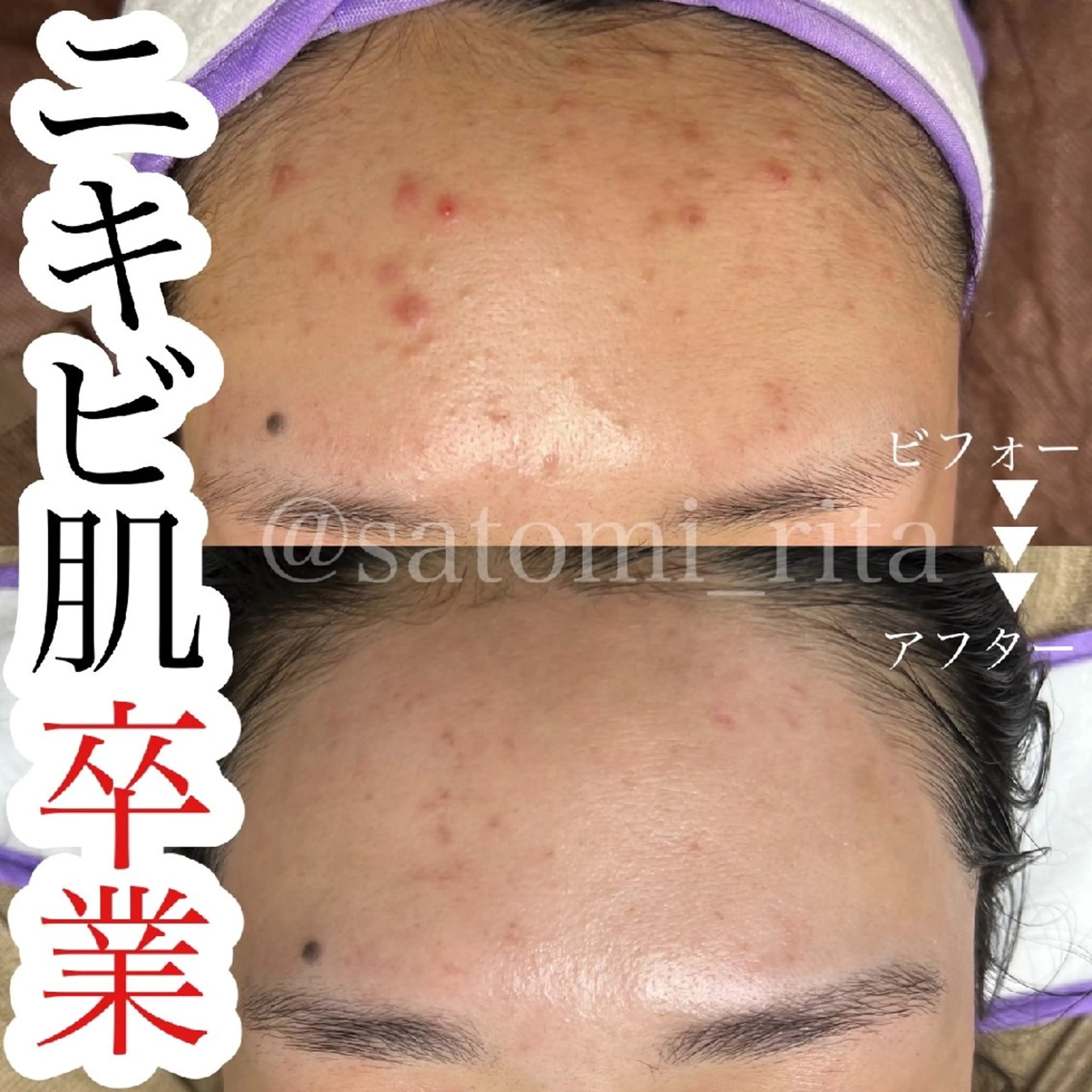 Rita eyelash＆waxing所属・Rita eye&waxのマツエク・マツパデザイン