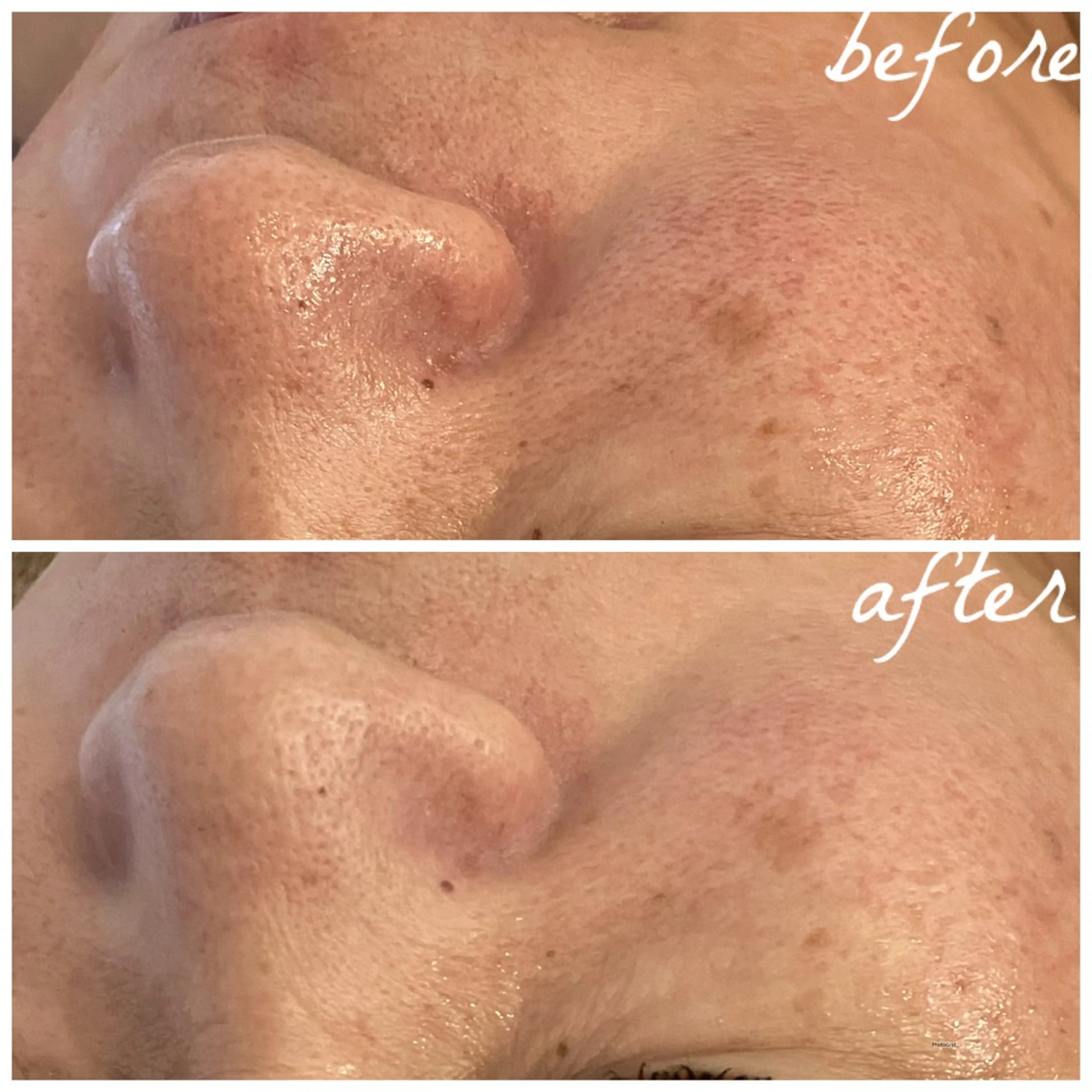 メンズ メナード岐阜茜部 杉浦のエステ・リラクイメージ