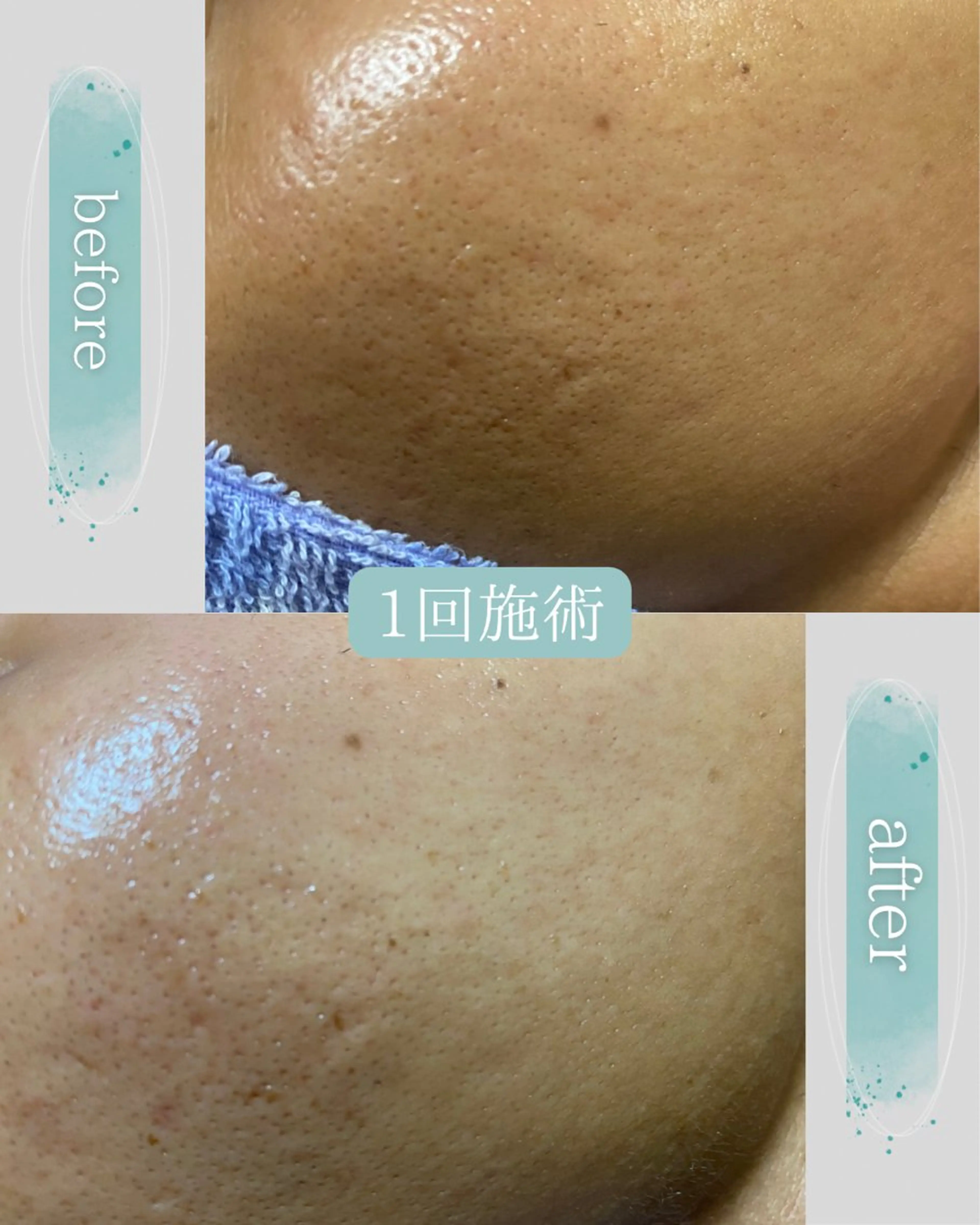 Life＆ Beautifulのエステ・リラクイメージ