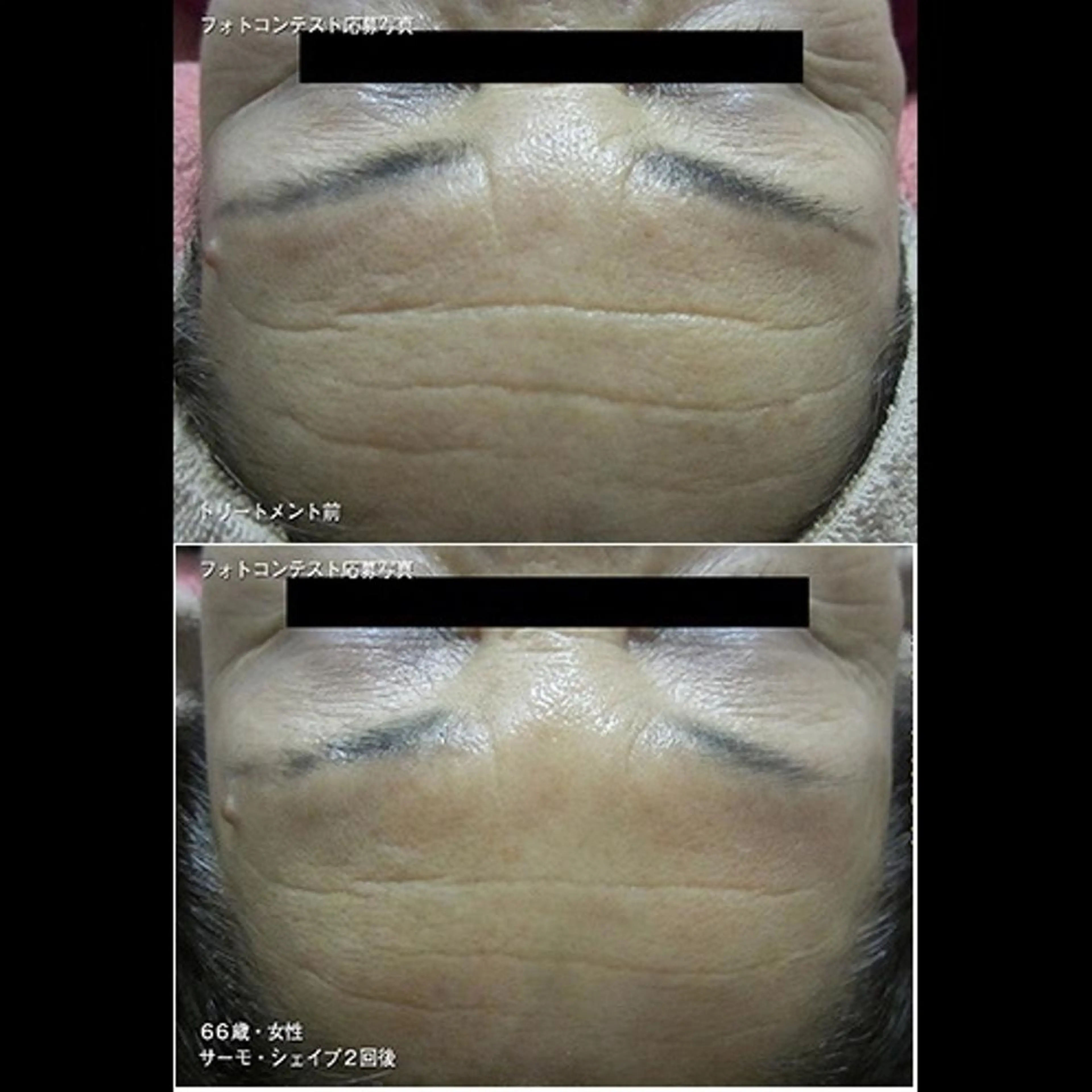 くびれ作り専門サロン こねこのシッポ虎ノ門のエステ・リラクイメージ