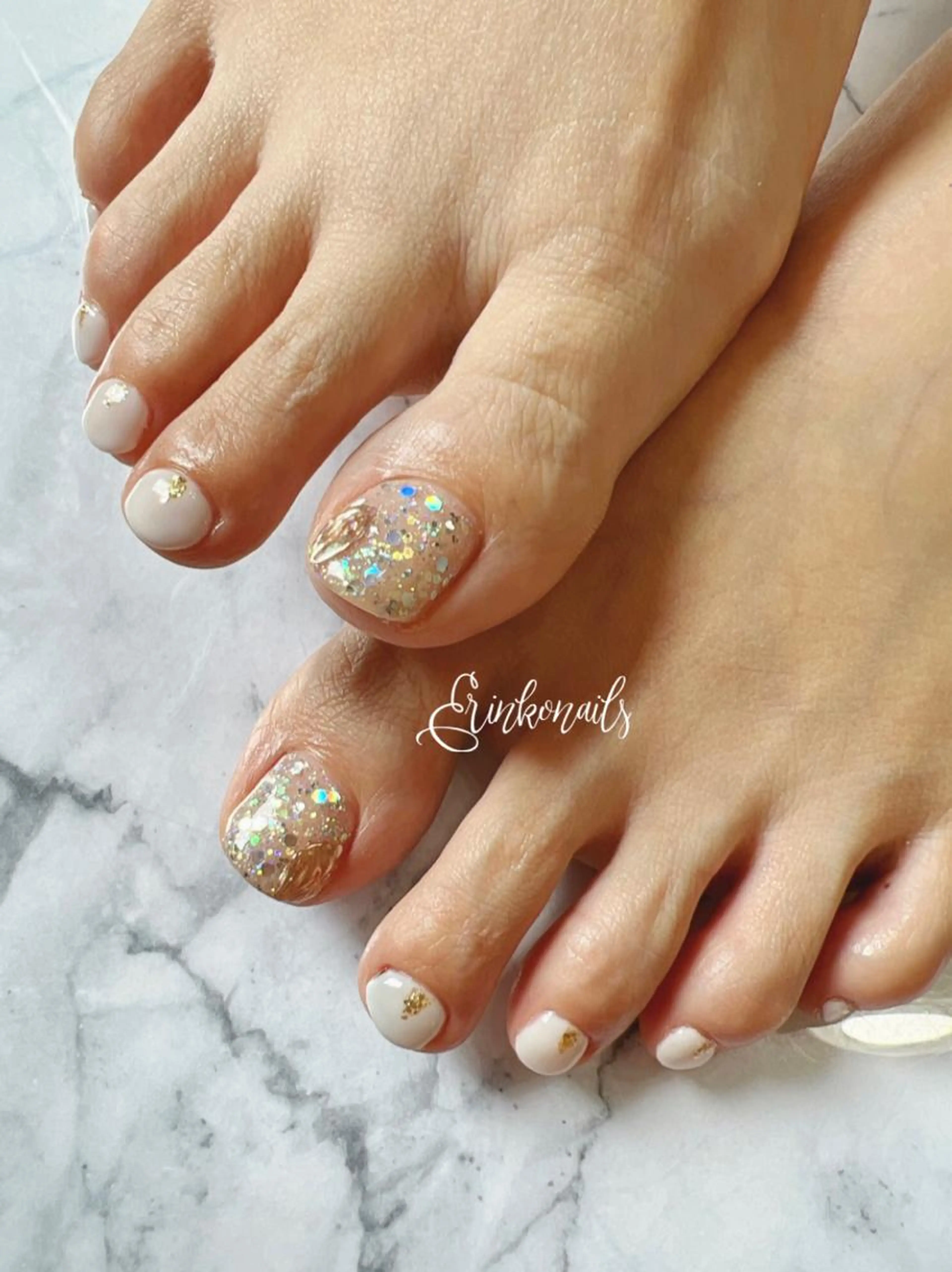 フットネイル(オフ込み・デザイン自由)の写真