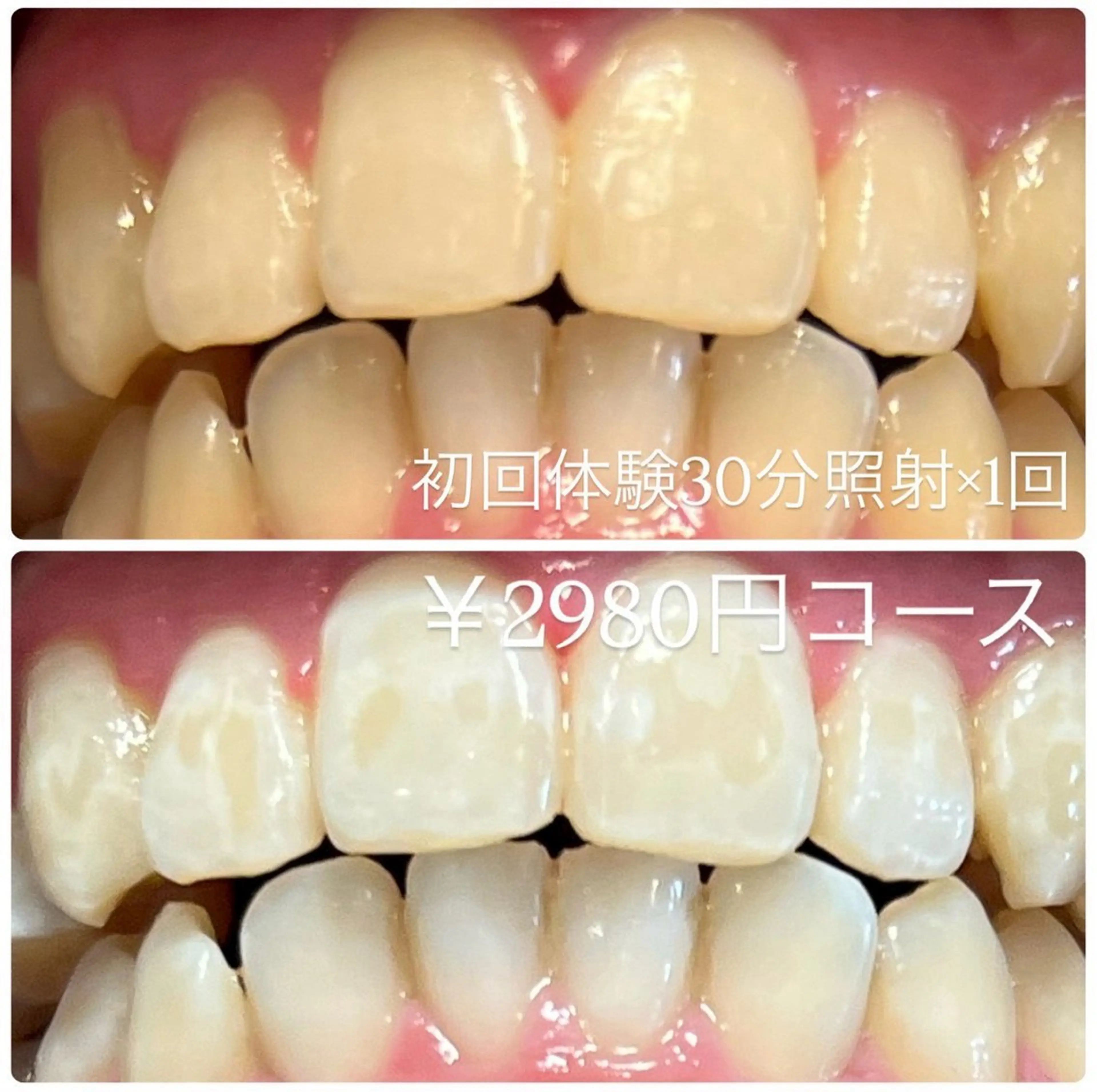 その他 PLATINUM Beauty 横浜店所属・ホワイトニングルーム 横浜店のその他イメージ