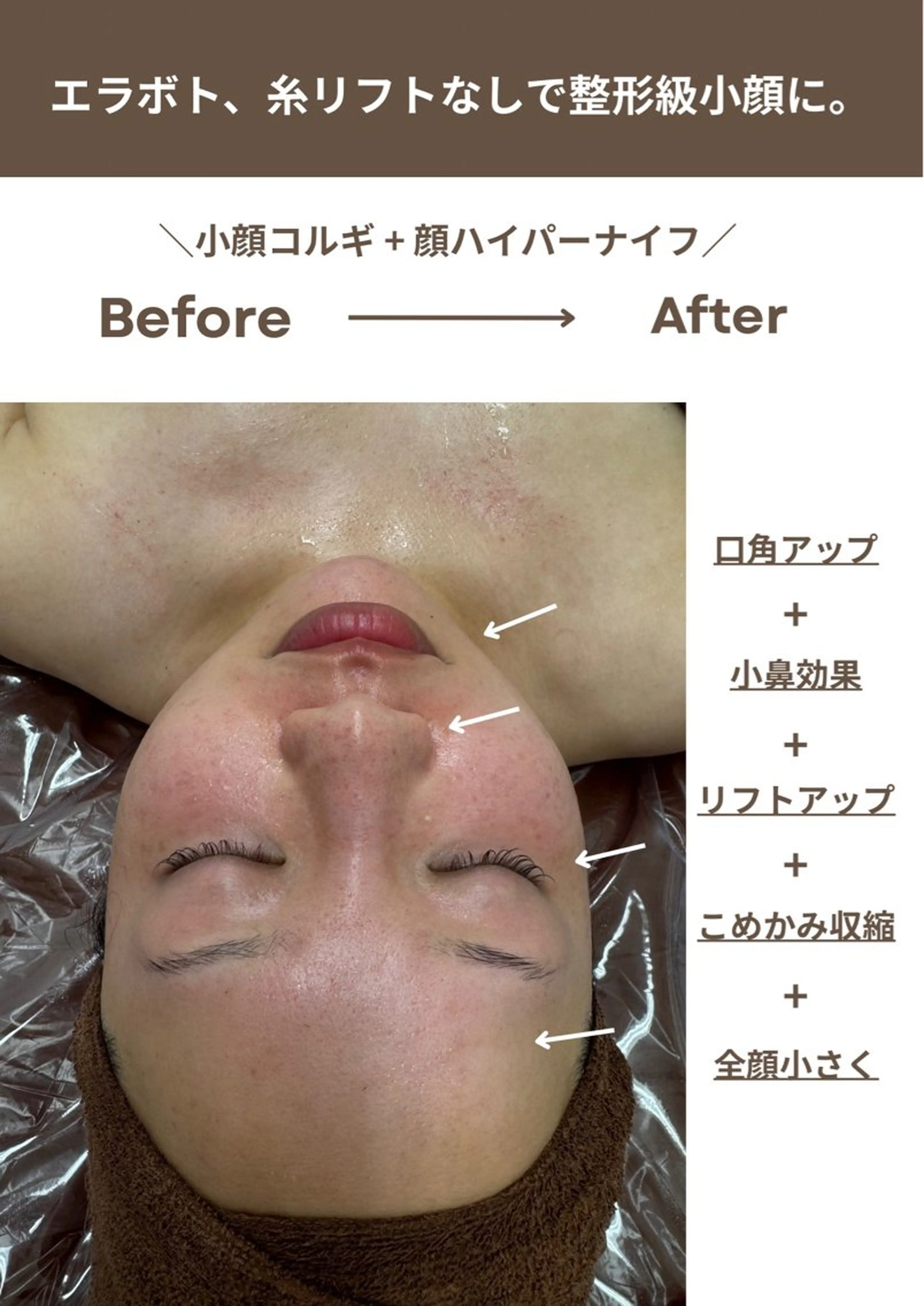 【他サロンにはない珍しいオリジナル】大人気整形級の小顔コルギ！オールハンドで腕、背中、首、顔、頭までしっかりほぐします✨の写真