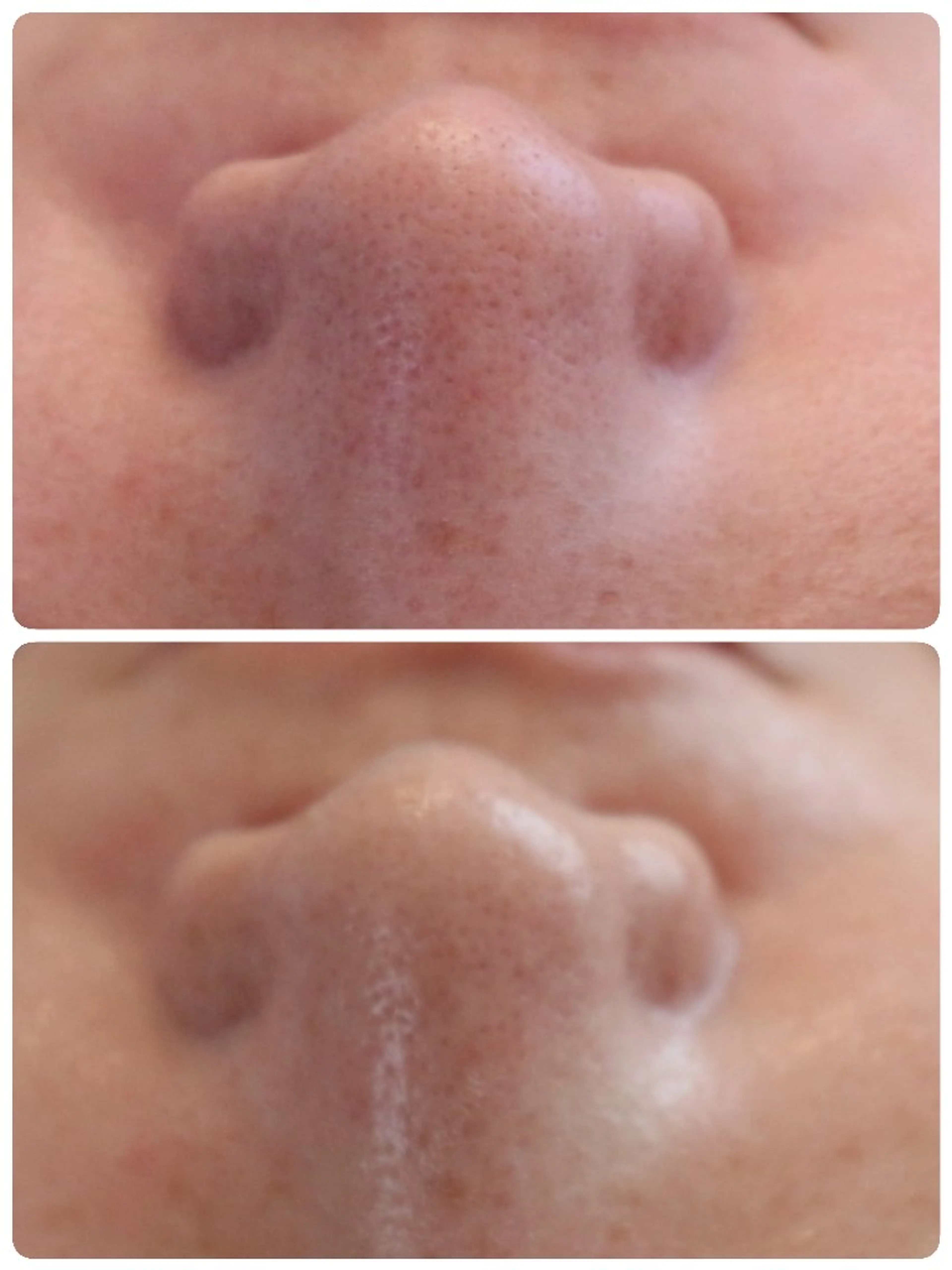 エステサロン NICOLIのエステ・リラクイメージ