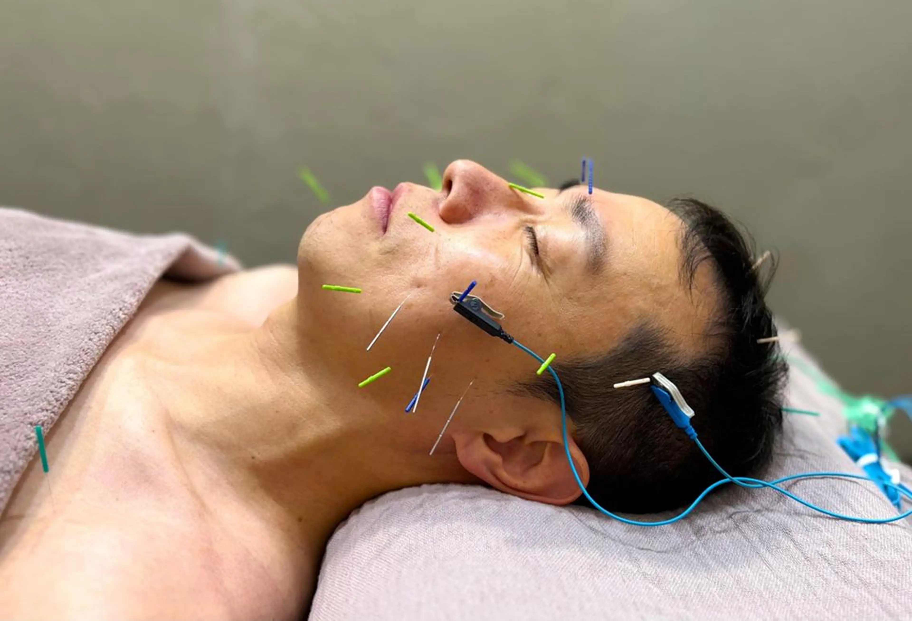 麻布十番/圧倒的小顔 毒出し美容🎀鍼灸のエステ・リラクイメージ