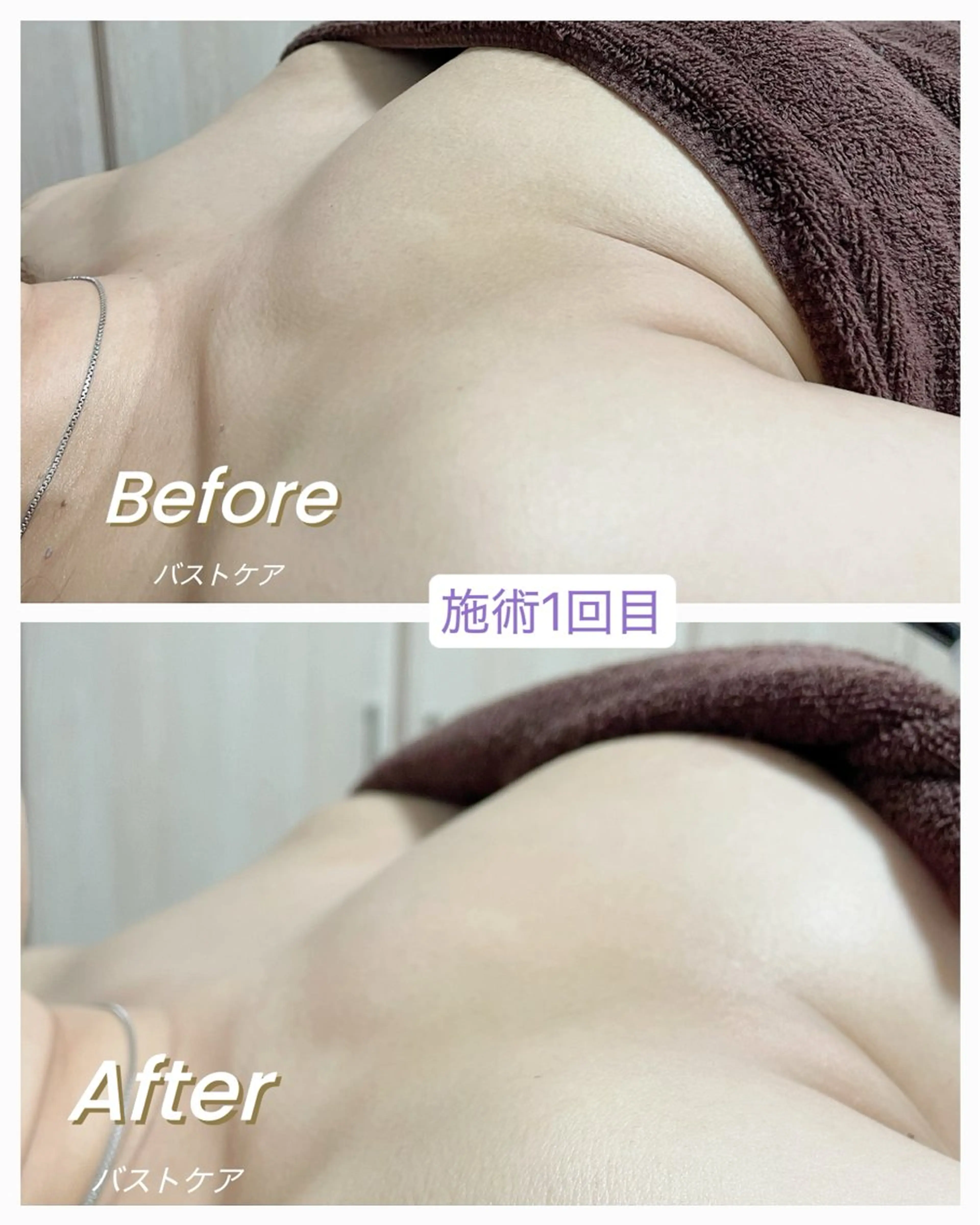 ◆ バストケアメソッド 《美乳形成トリートメント込》× 耳つぼジュエリー💎の写真