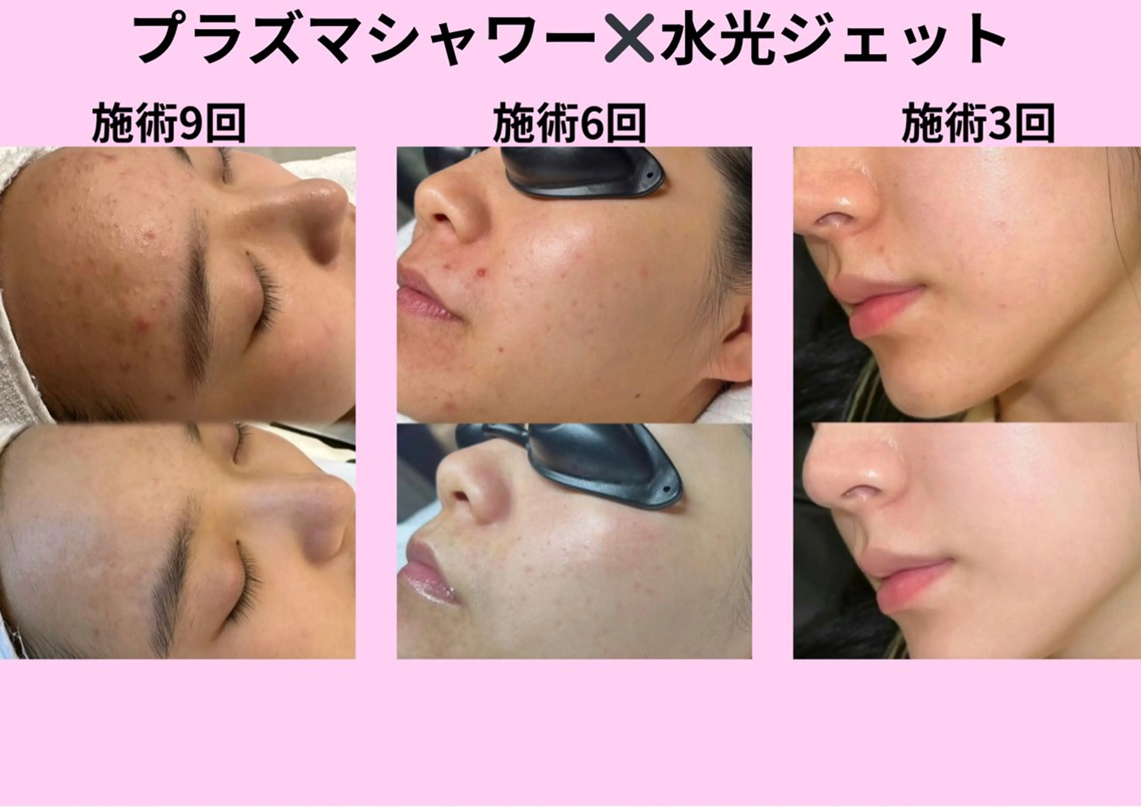 マツエク・マツパ エステ リラク 愛維美水光美肌専門店所属・愛維美水光美肌専門店 メンズレディースokのエステ・リラクイメージ