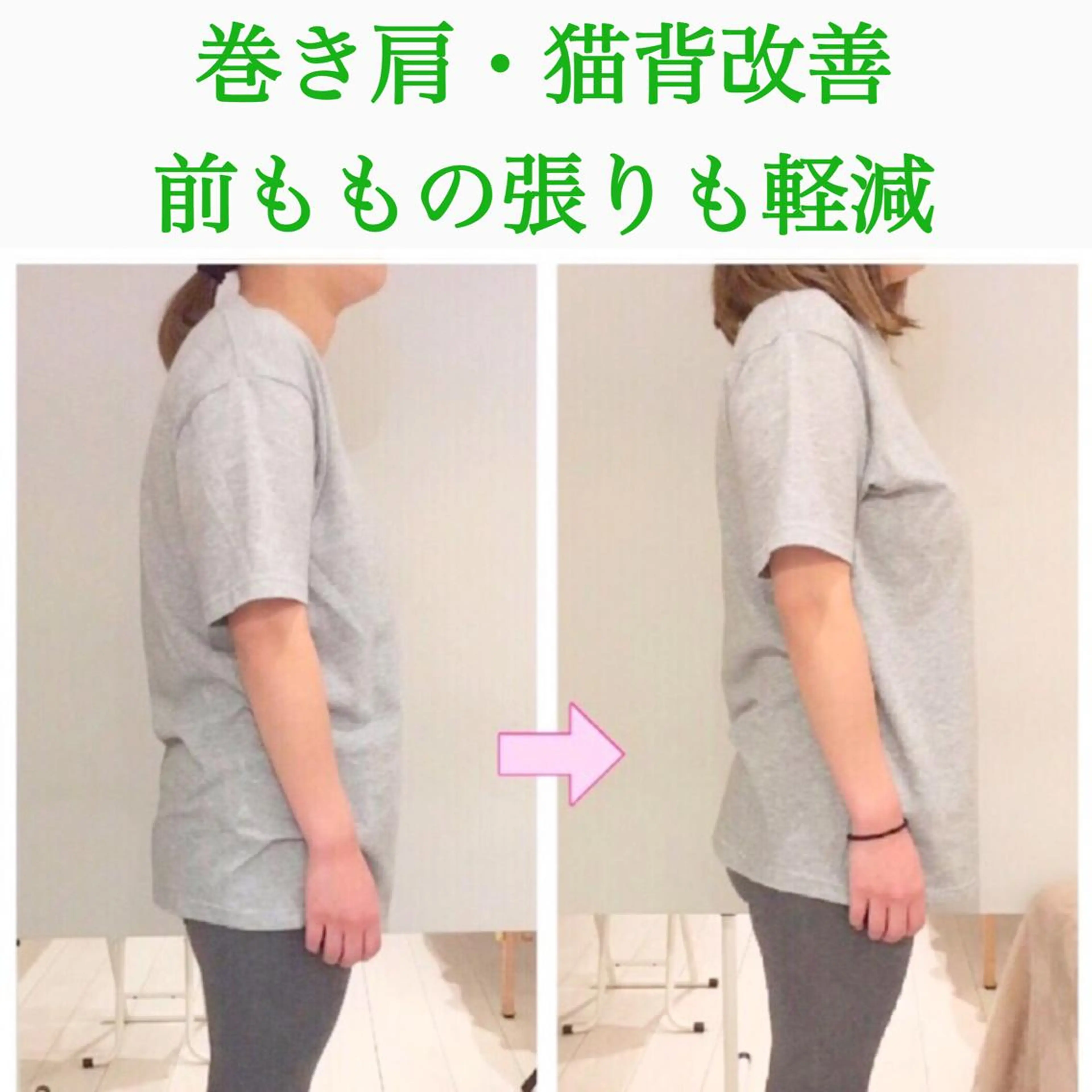 小顔モニター 募集のエステ・リラクイメージ