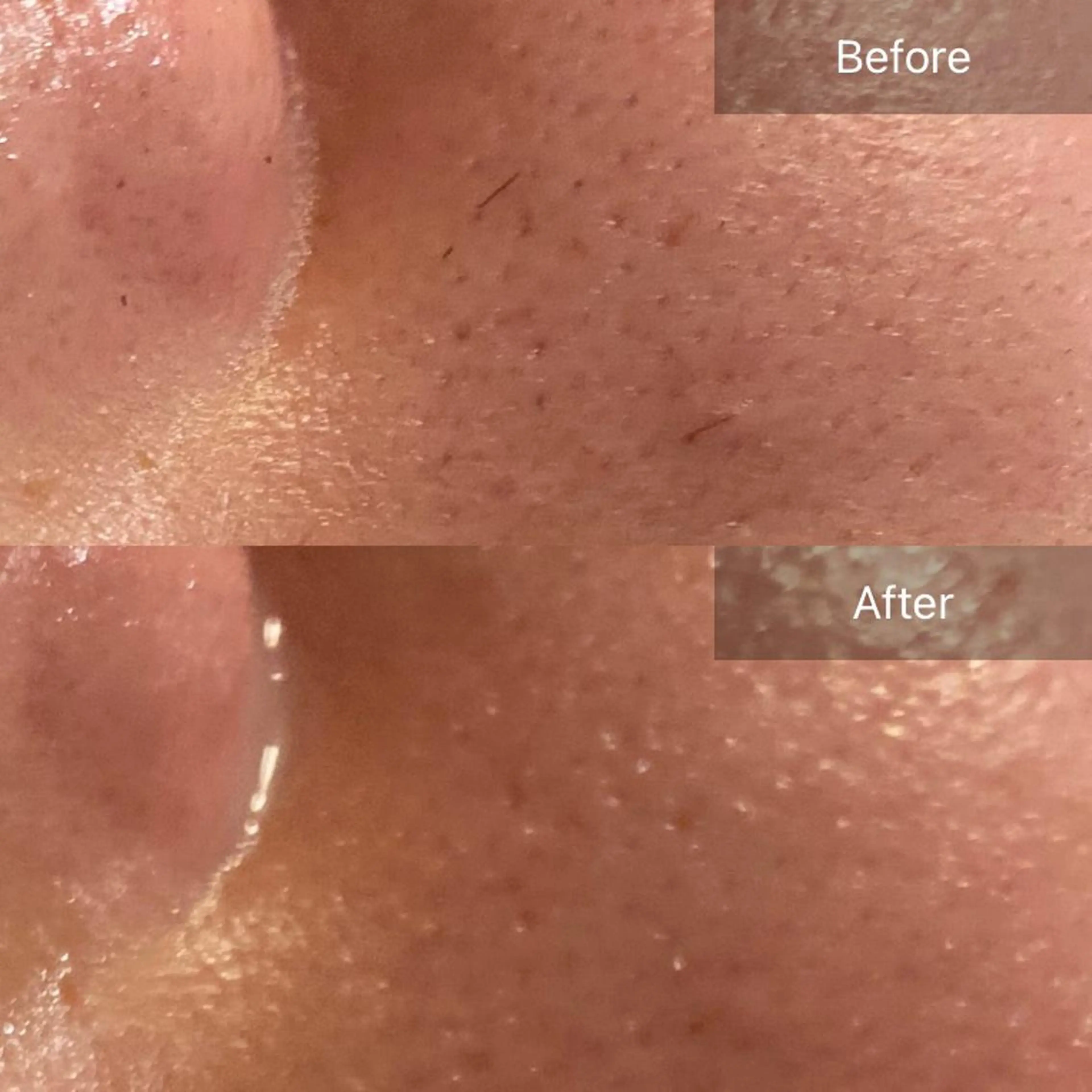 Mandarin Orange所属・毛穴から始める肌メン テマンダリンオレンジのエステ・リラクイメージ