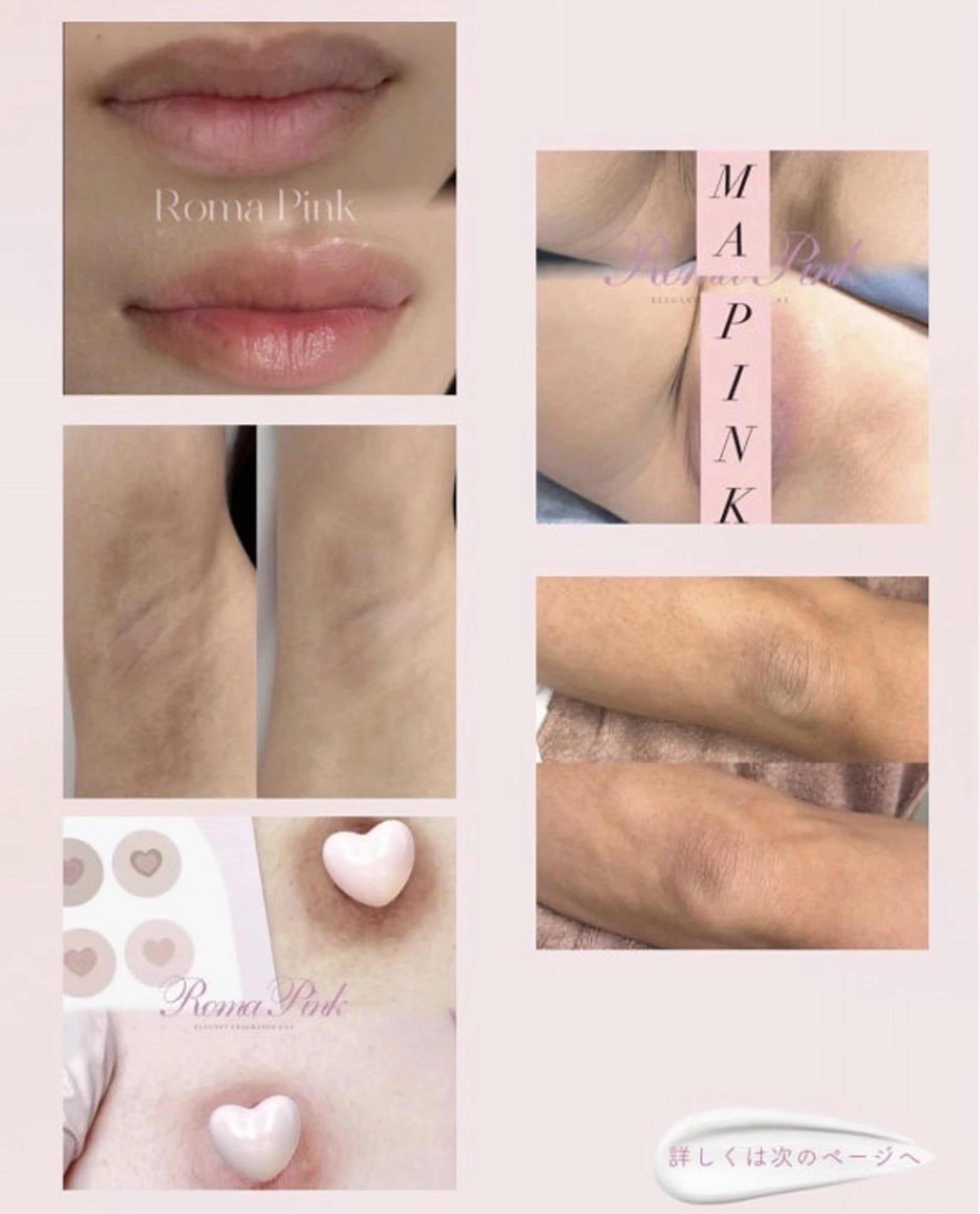 エステ 肌改善専門 浦和美園のエステ・リラクイメージ