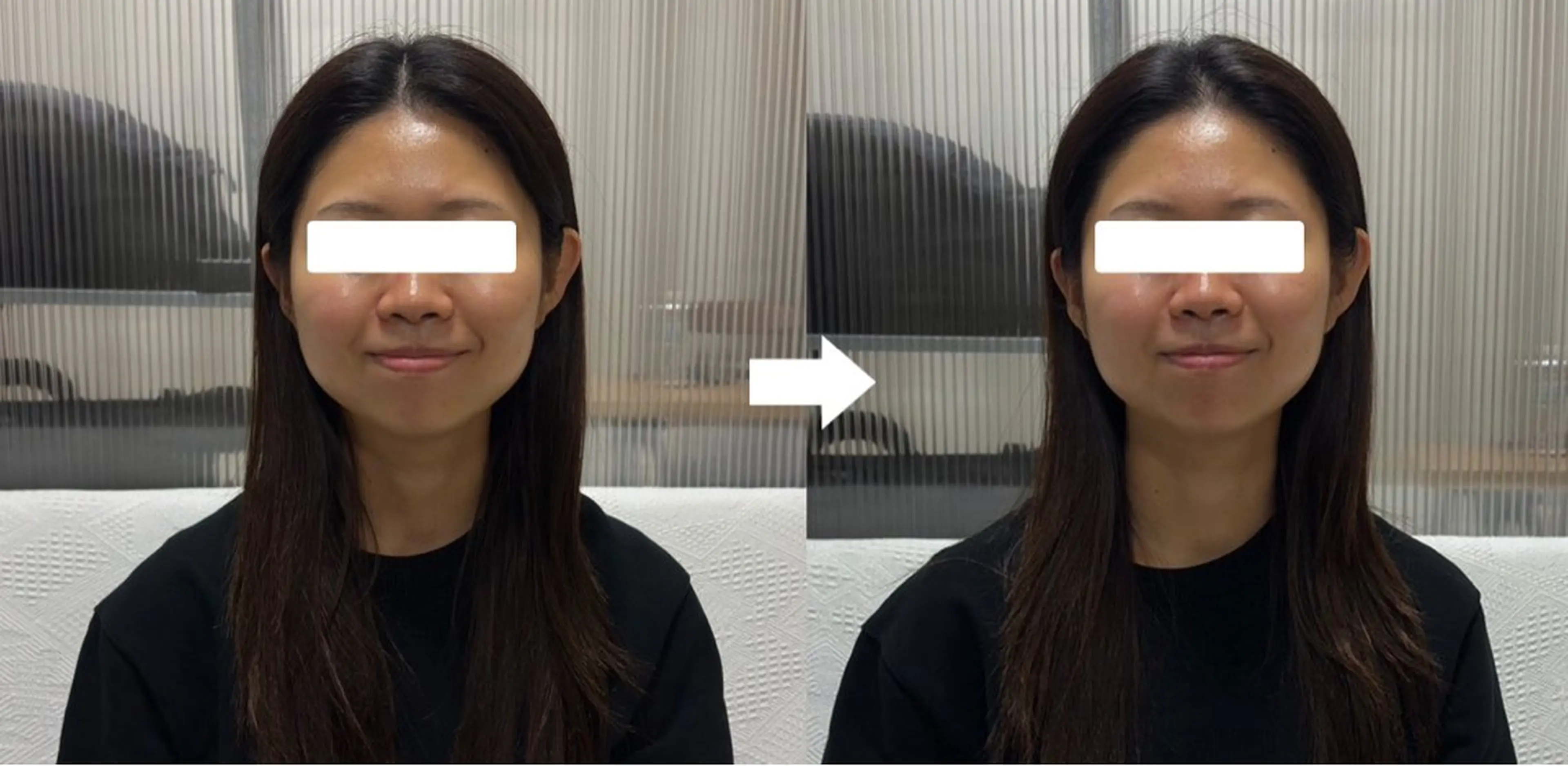 【1月お誕生日の方限定】ヘッドマッサージ2000円💆‍♀️の写真