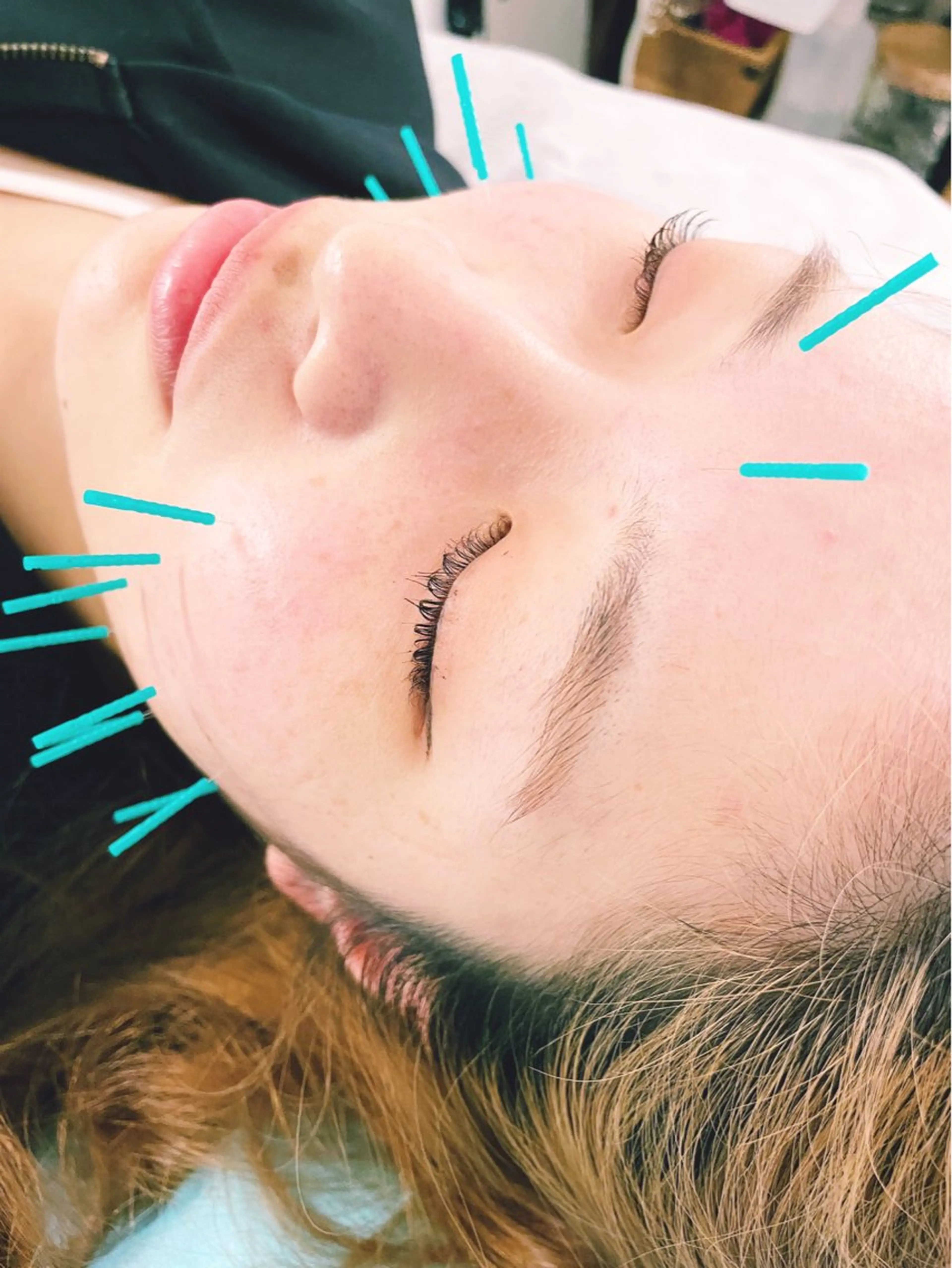 エステ リラク 小顔美容鍼専門サロン 渋谷YZのエステ・リラクイメージ