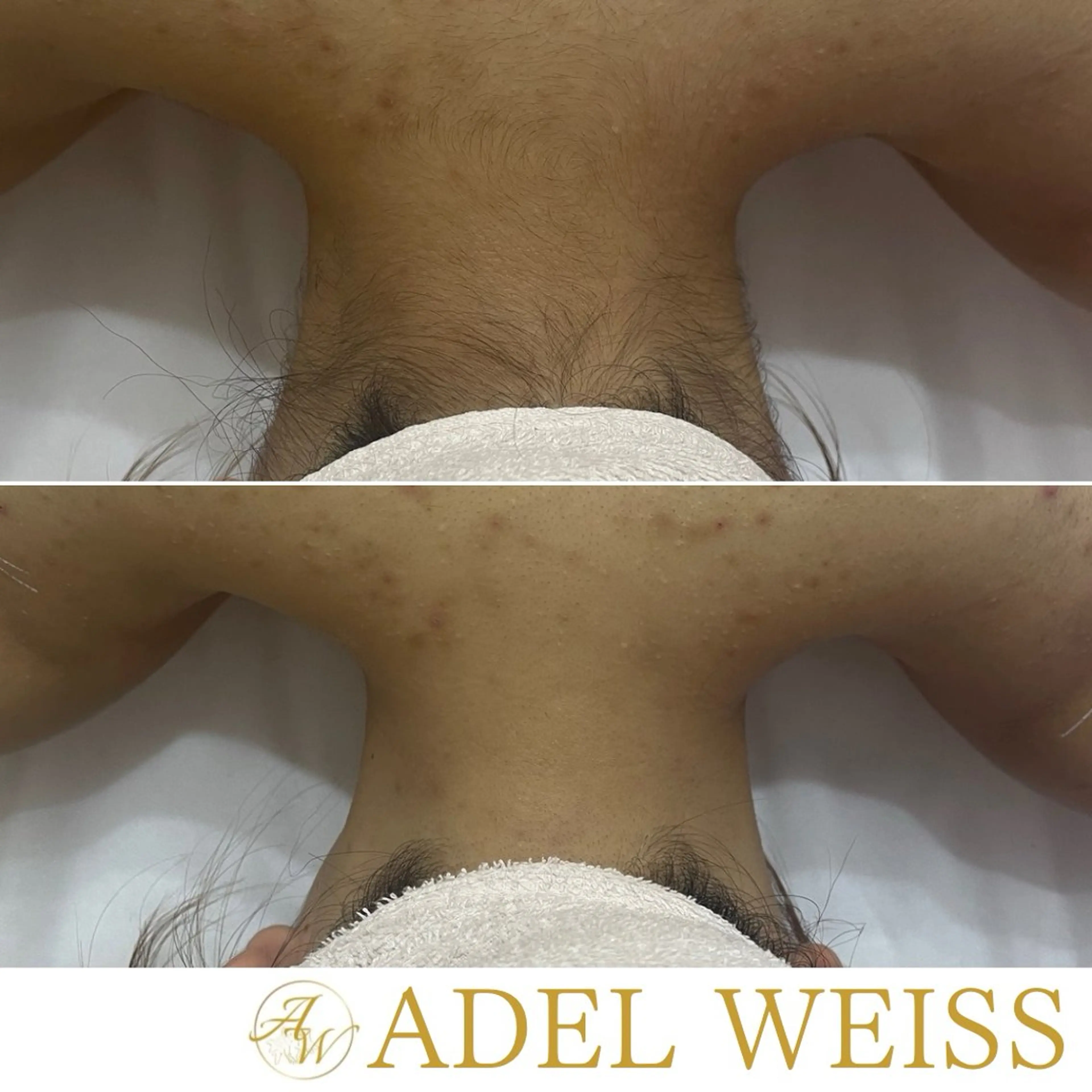 脱毛 Total Beauty Salon　ADEL WEISS所属・ADEL WEISS 脱毛＆毛穴＆リンパのエステ・リラクイメージ