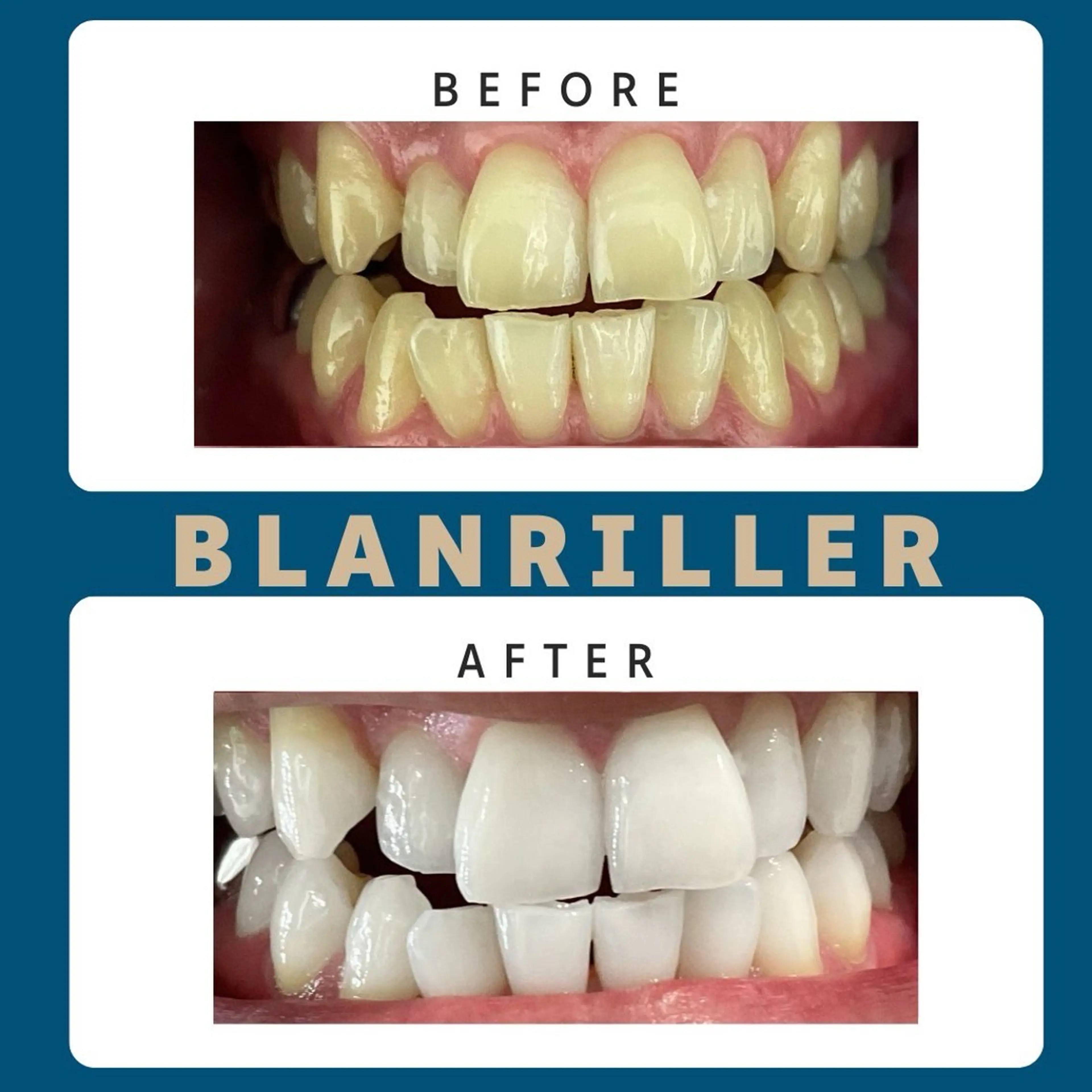 BLANRILLER所属・ホワイトニングサロン ブランリエ阿倍野店のその他イメージ