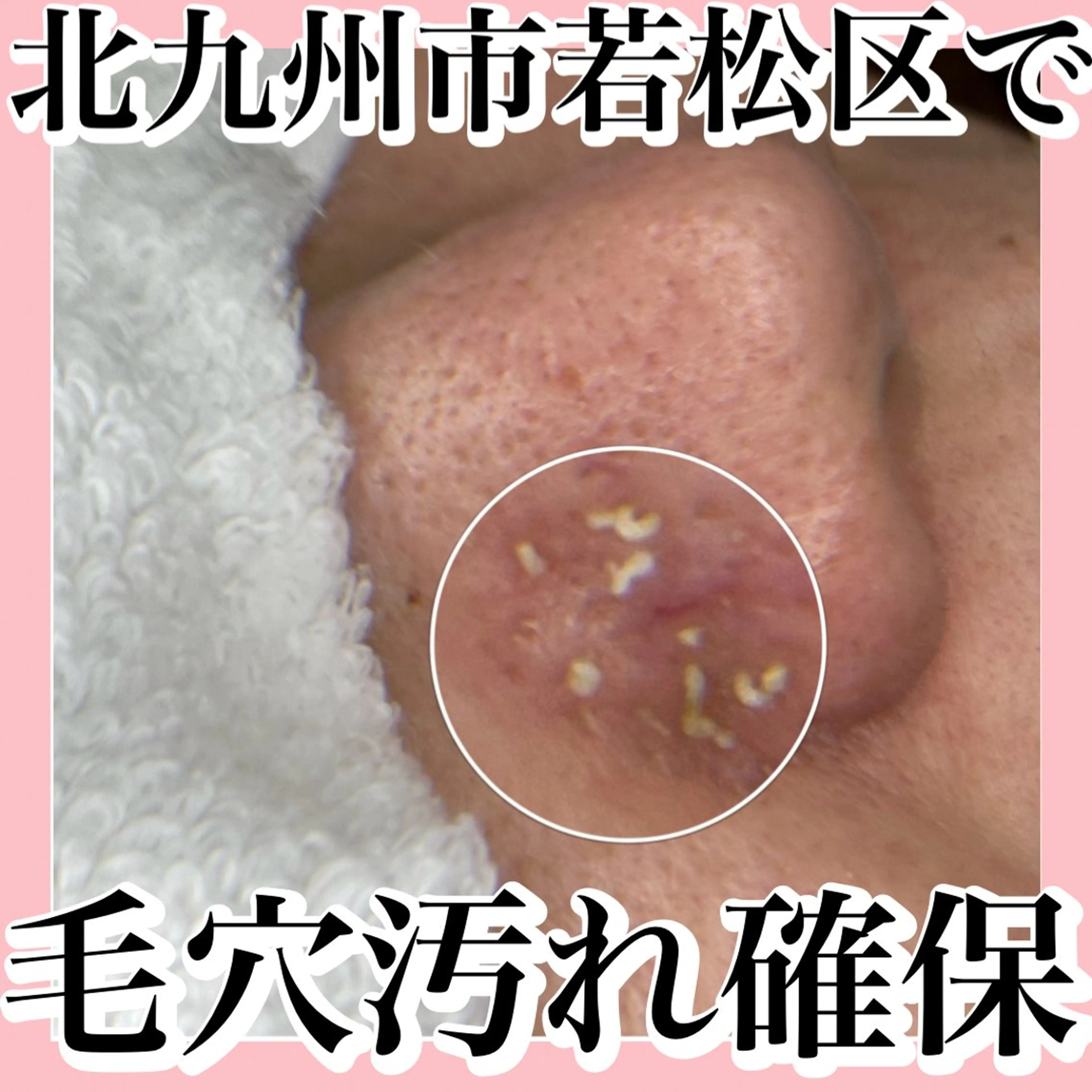 毛穴美人コースの写真