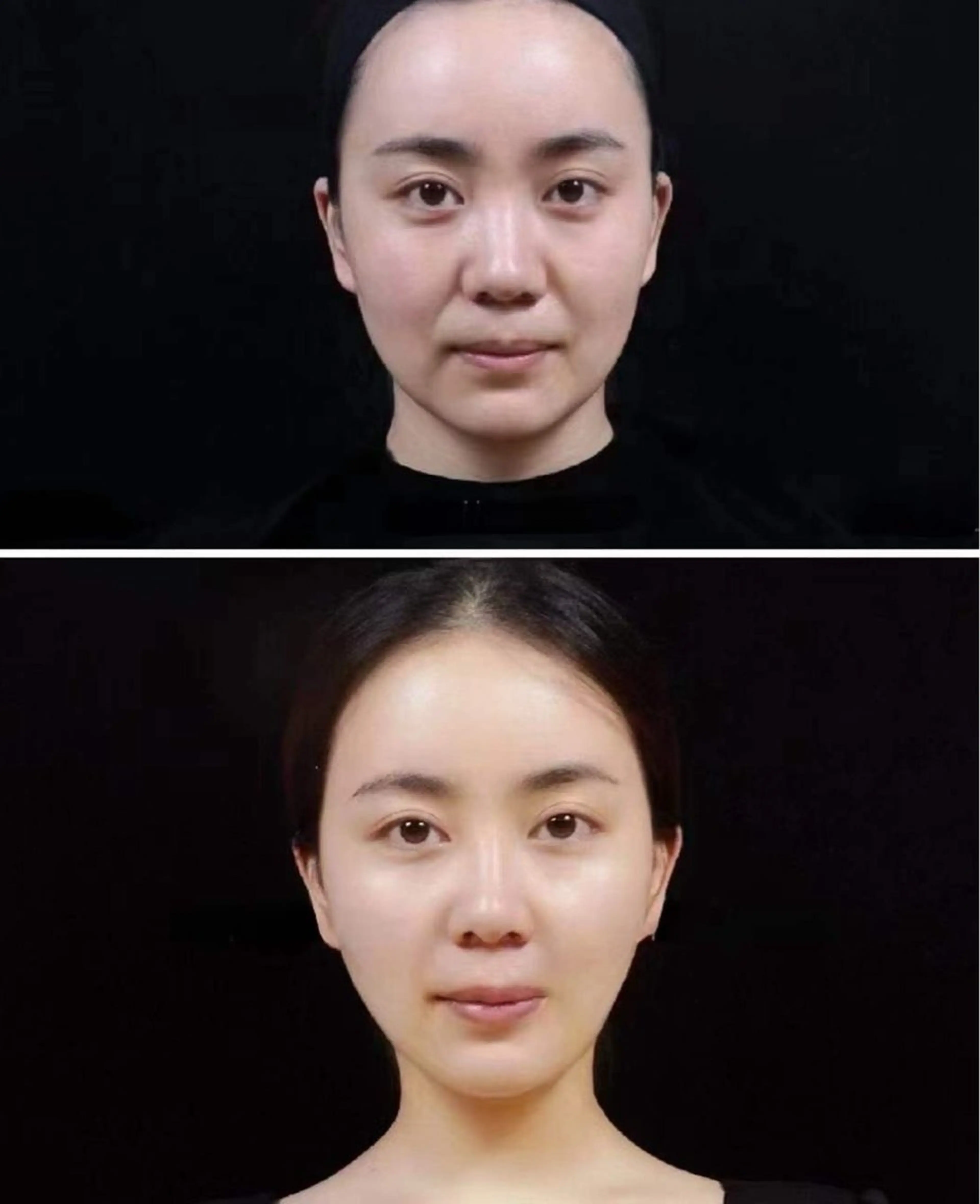 ネイル ブライダルネイル ホワイト aliaハイフ&水光ジェットサロン所属・aliaハーブ水光店 エステティシャン募集のエステ・リラクイメージ