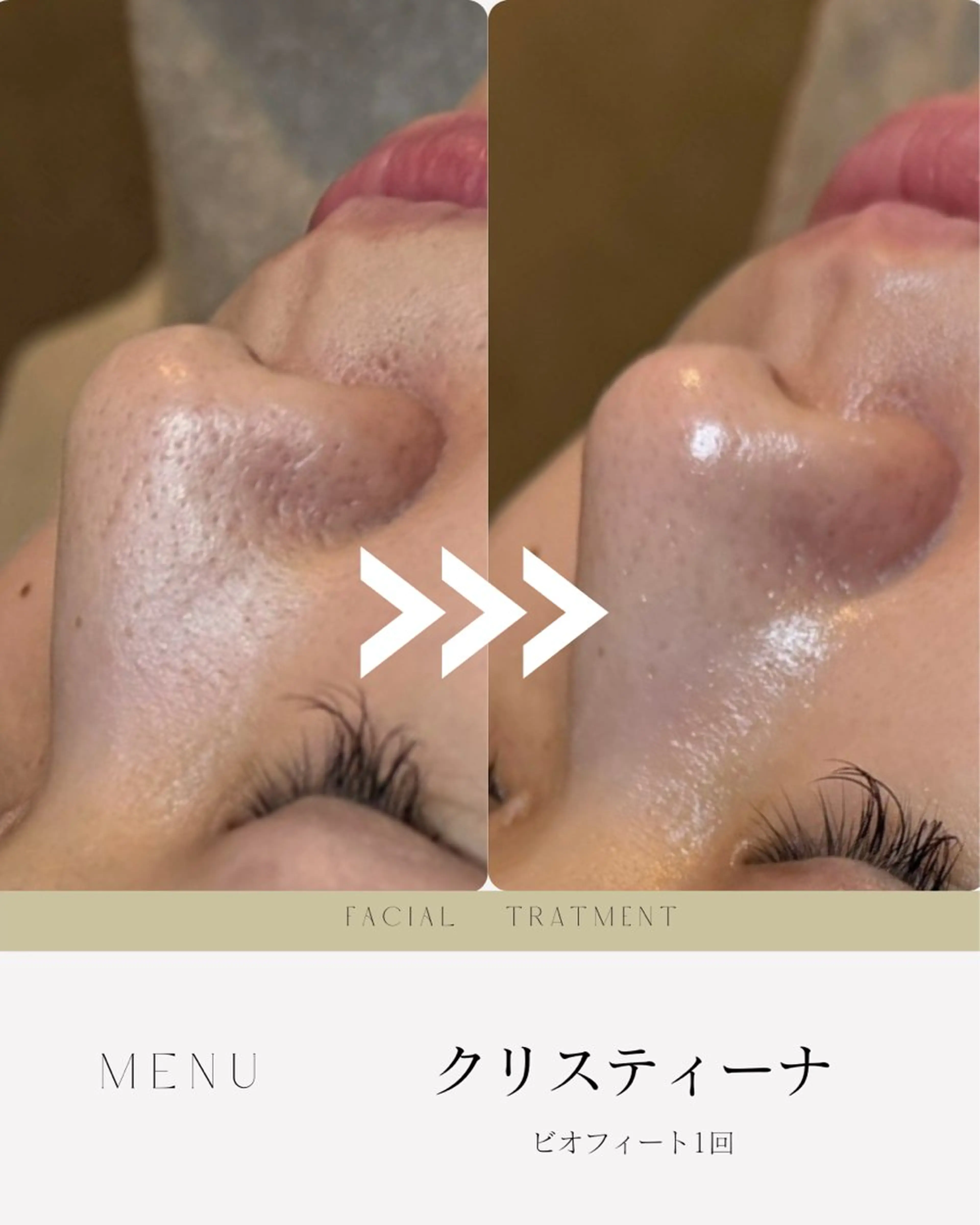 エステ atelier design 【アトリエデザイン】所属・肌質・体質改善✖️ 小顔｜Rikaのエステ・リラクイメージ