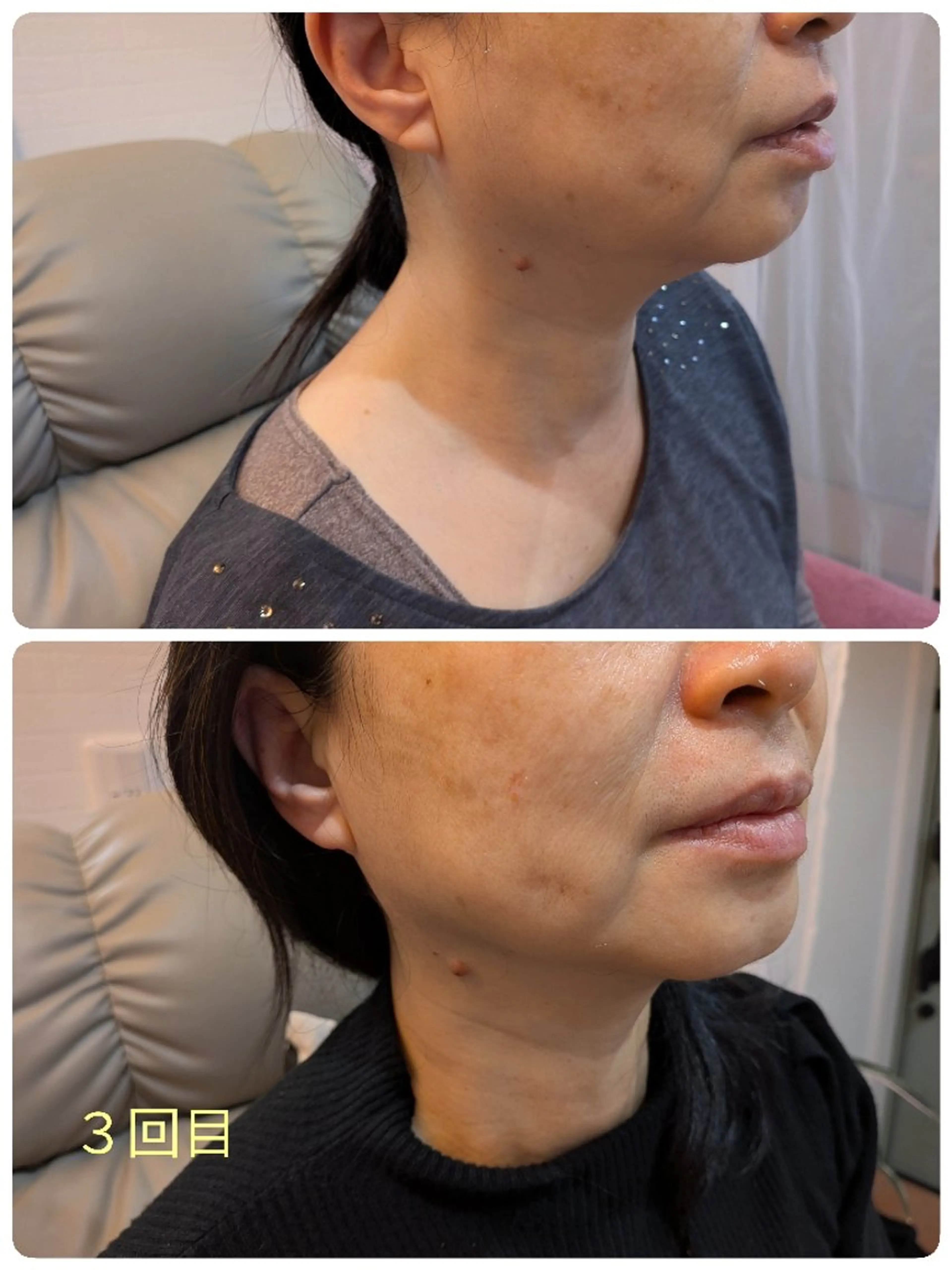 エステ リラク A.Nails salonのエステ・リラクイメージ