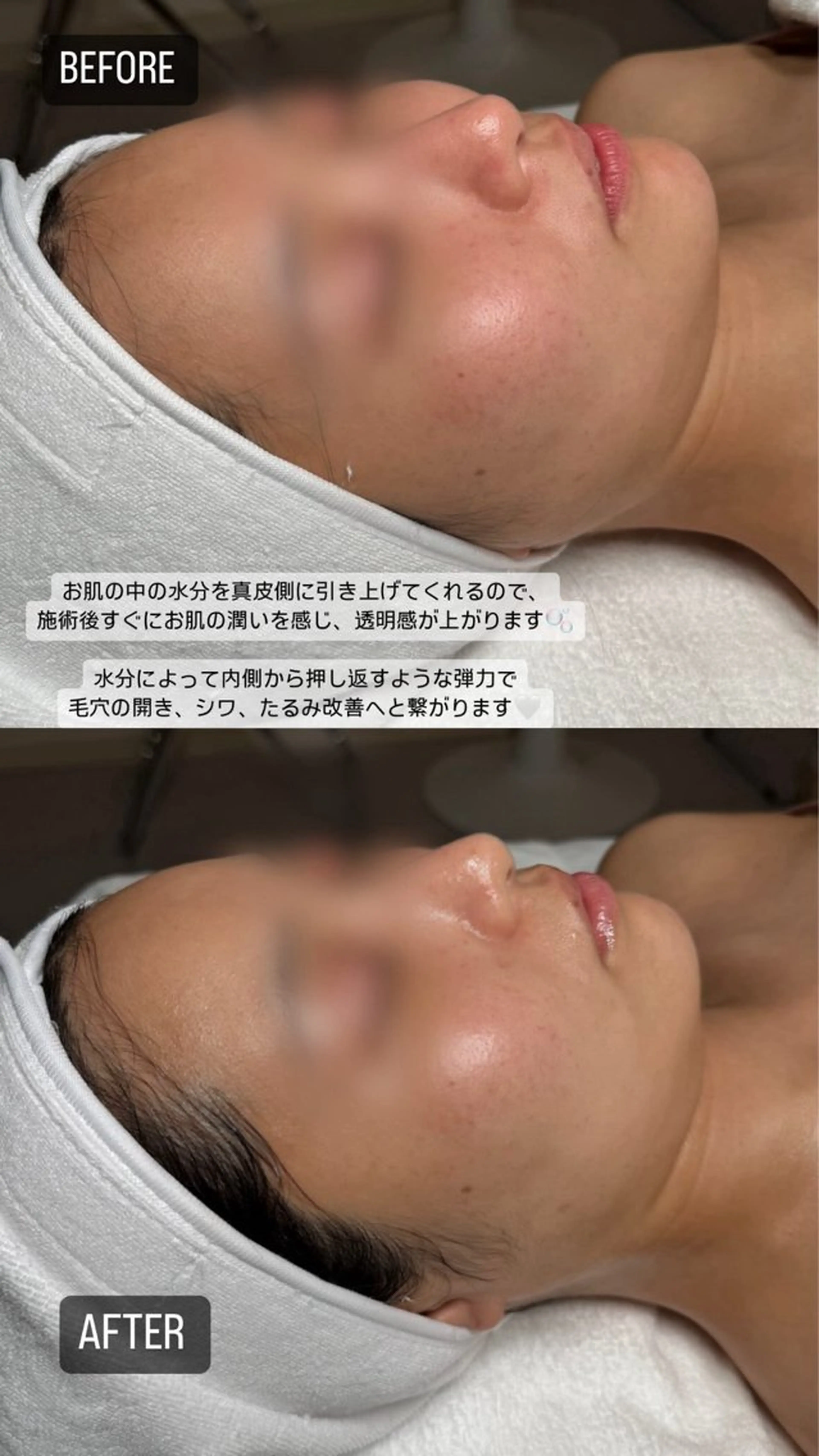 韓国肌管理🫧LDM 🫧Junnaのエステ・リラクイメージ