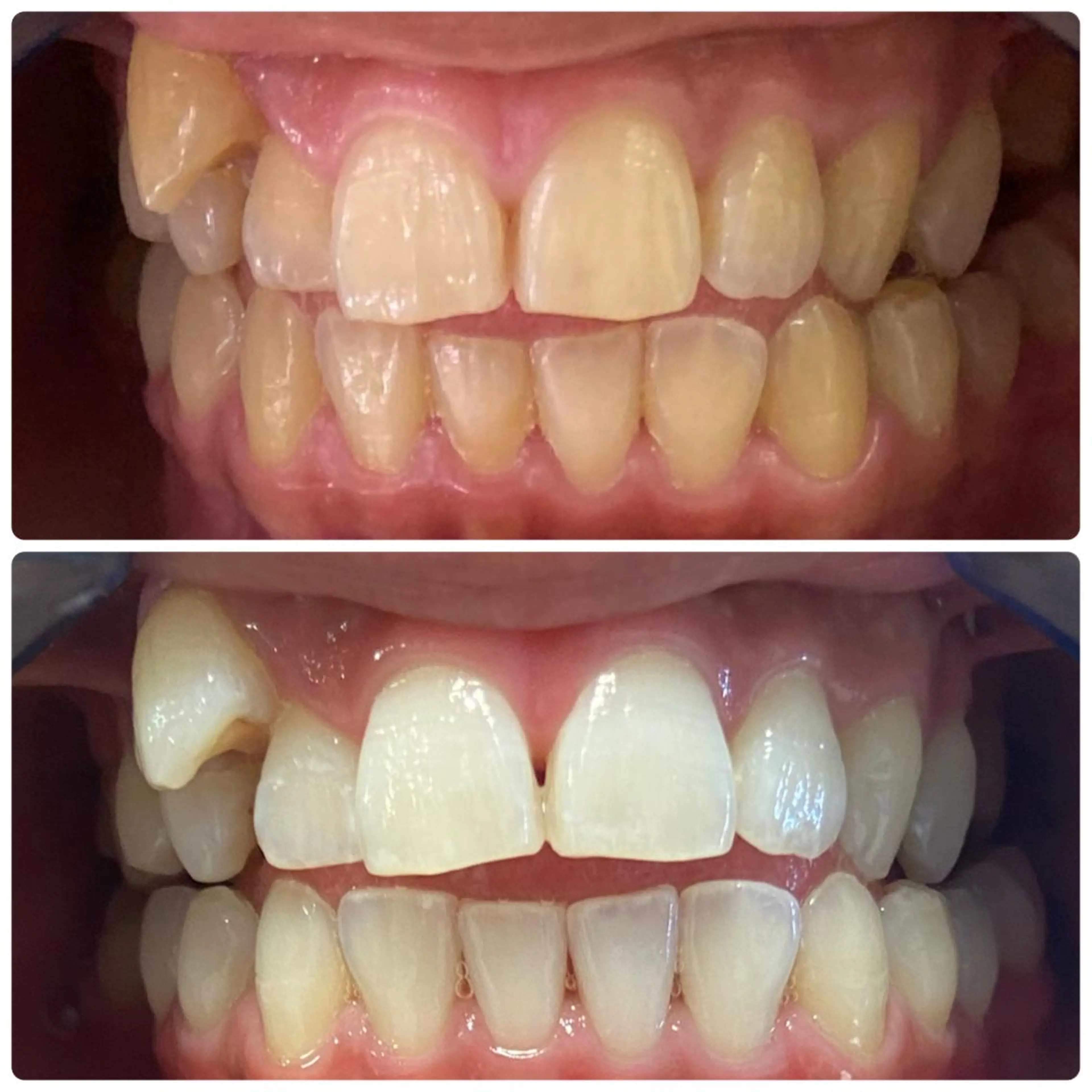 その他 PLATINUM Beauty 横浜店所属・ホワイトニングルーム 横浜店のその他イメージ