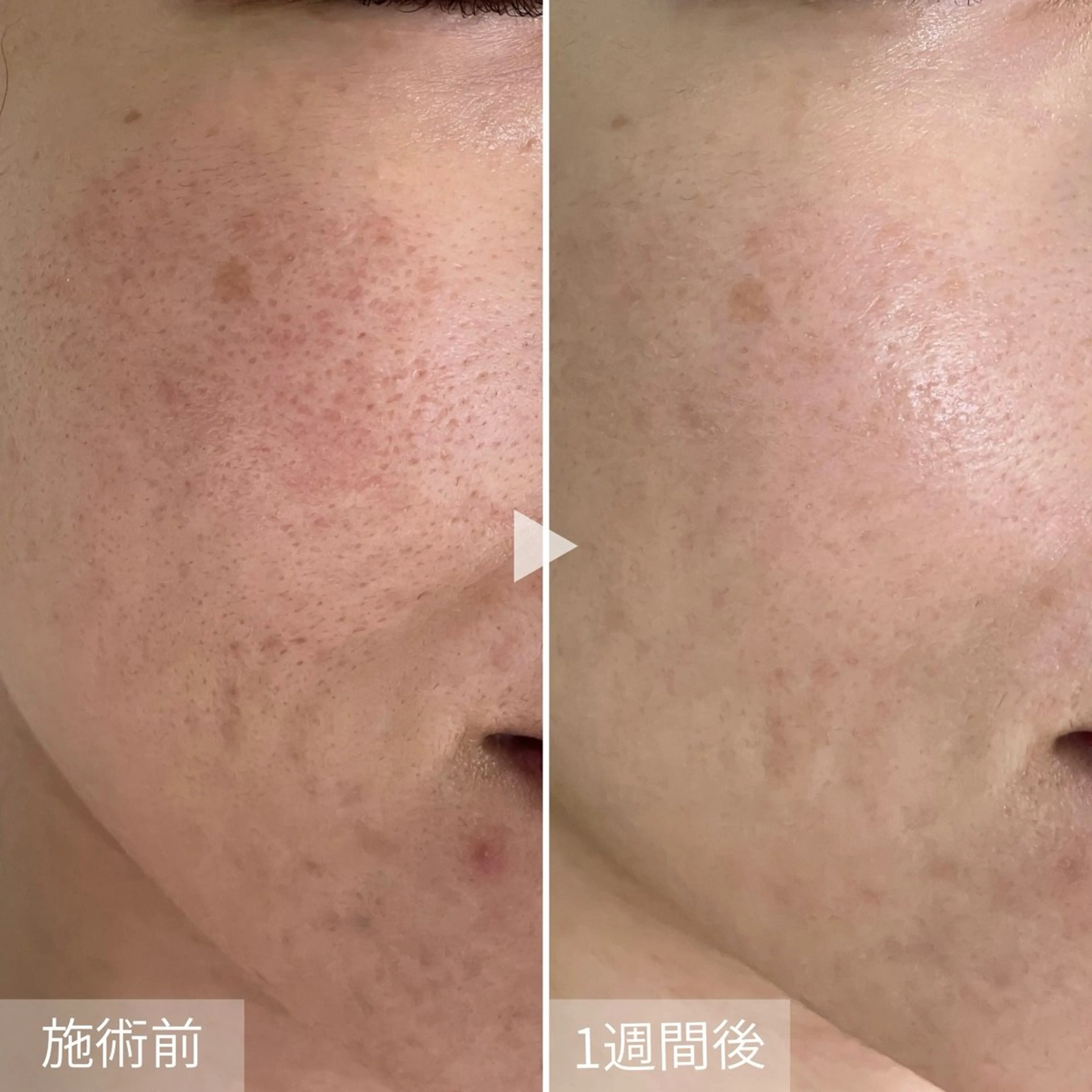 エステ シェノン所属・ニキビ・毛穴・ フェイシャル専門店のその他イメージ