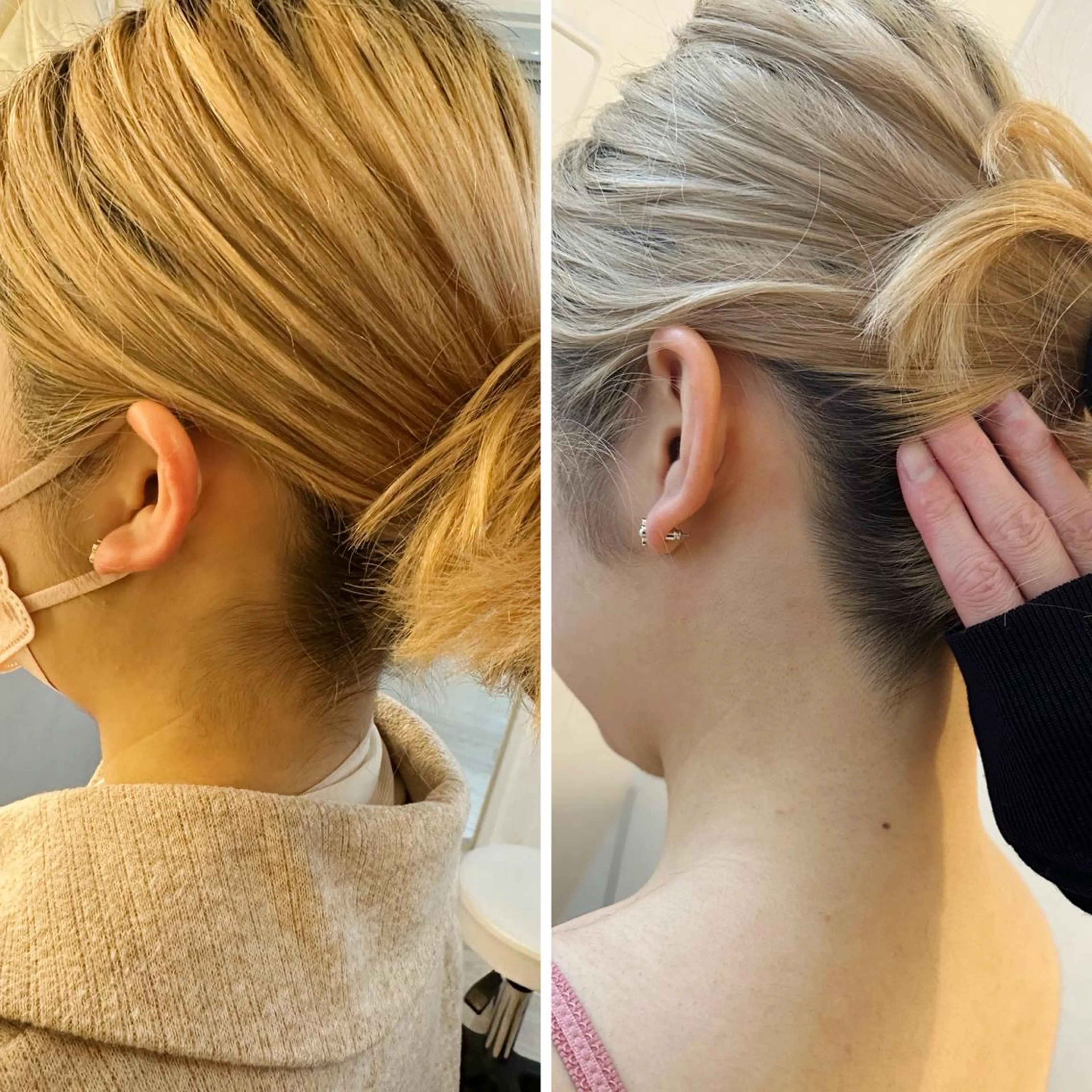 うなじ脱毛/美肌脱毛 LABELのエステ・リラクイメージ