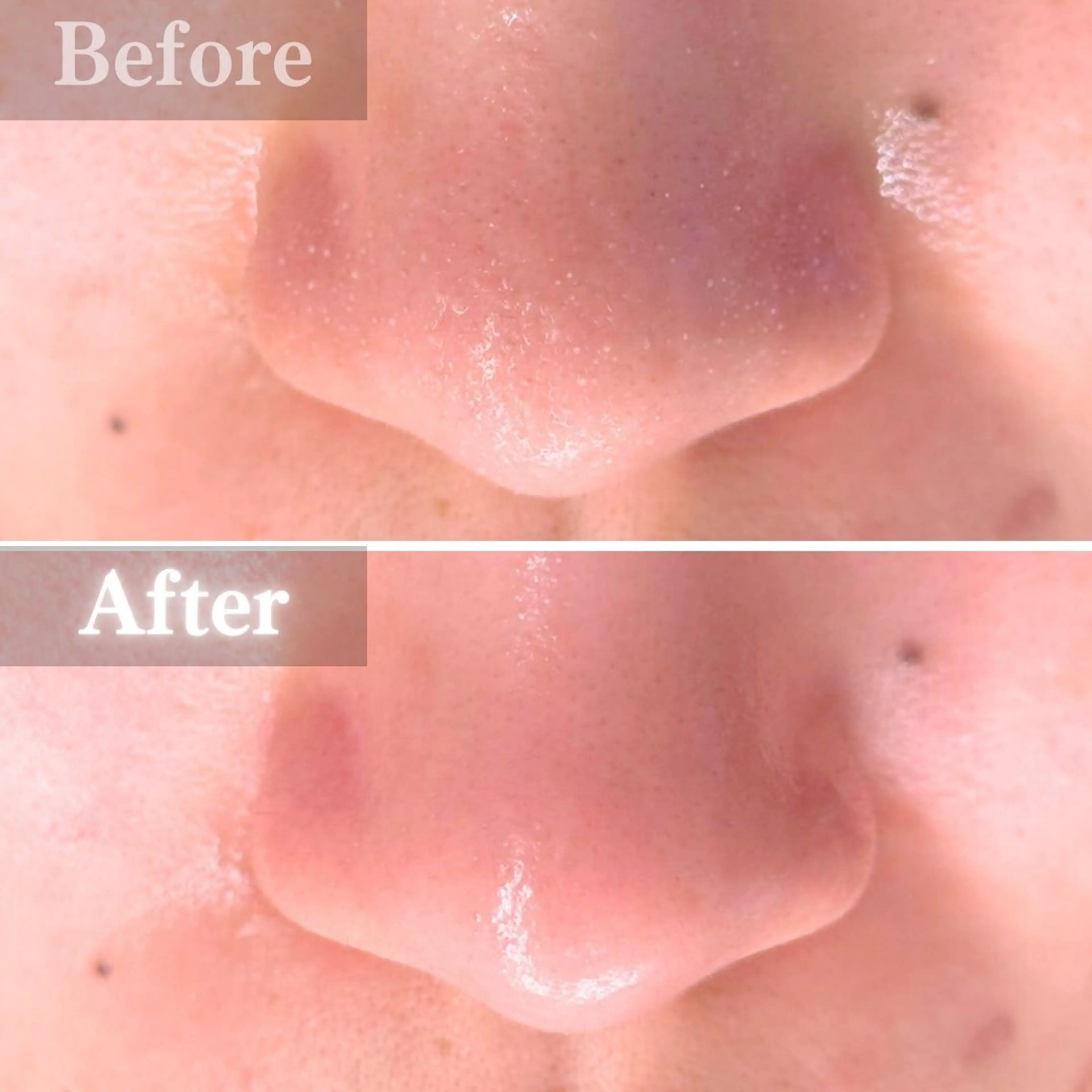 エステ 毛穴洗浄特化🫧 オオツカのエステ・リラクイメージ