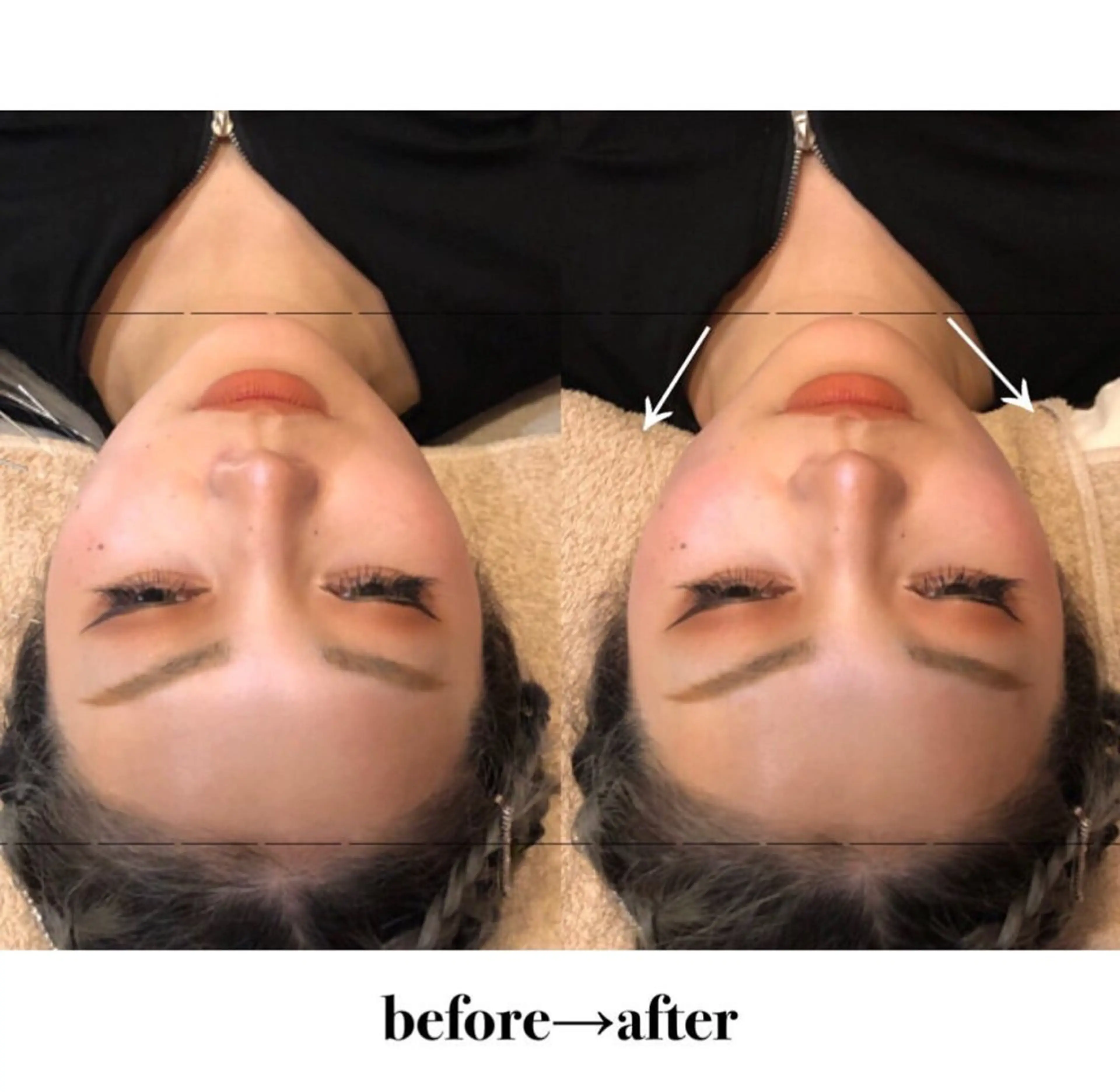 THE  ROOTS所属・美容鍼♡小顔矯正♡ fumikaのエステ・リラクイメージ