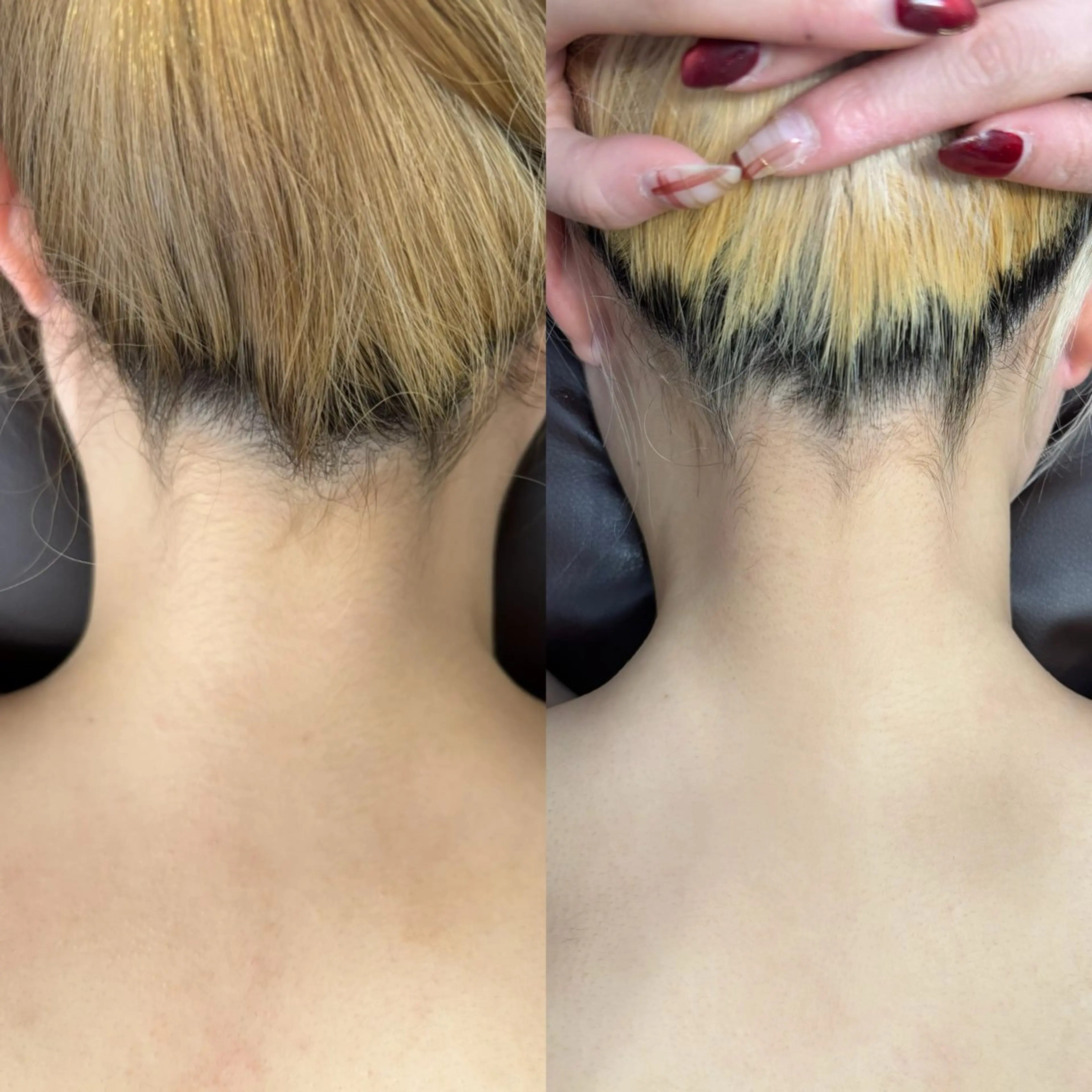 脱毛 恩地 憂のエステ・リラクイメージ