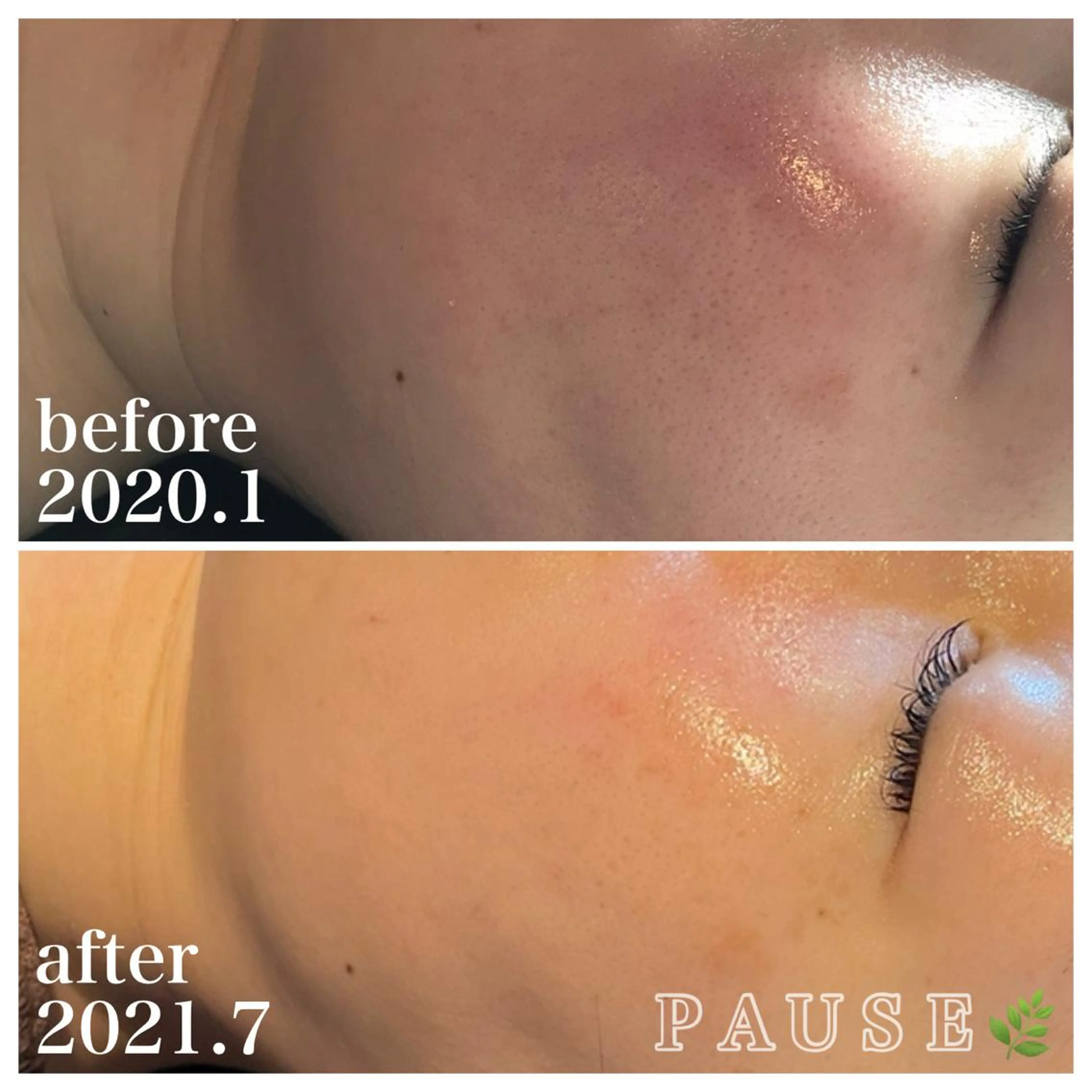 エステ 浜野 恵美のエステ・リラクイメージ