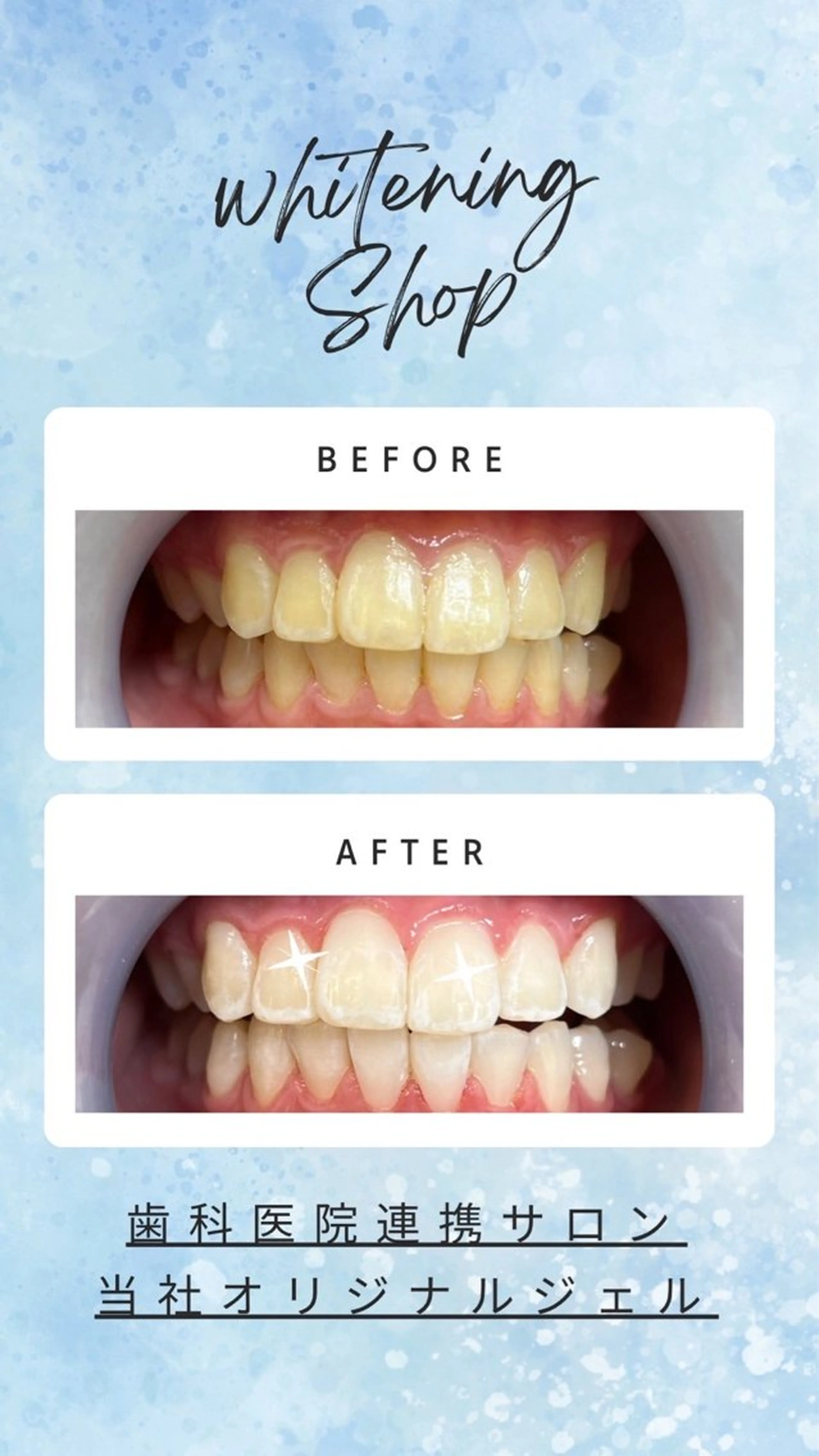 ホワイトニングショップ　高松瓦町店所属・ホワイトニング ショップ 高松瓦町のその他イメージ