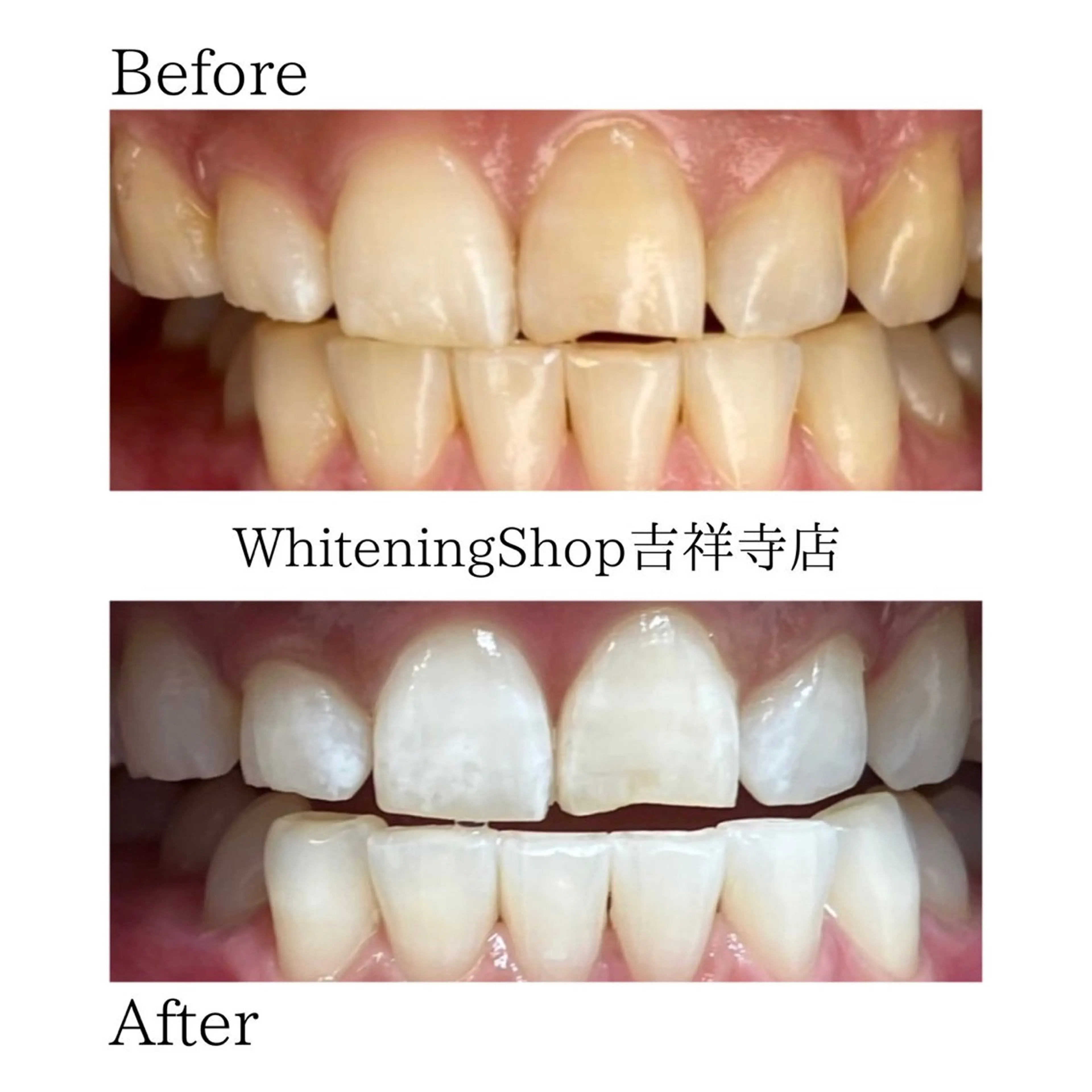 エステ リラク ホワイトニング ショップ吉祥寺店のエステ・リラクイメージ