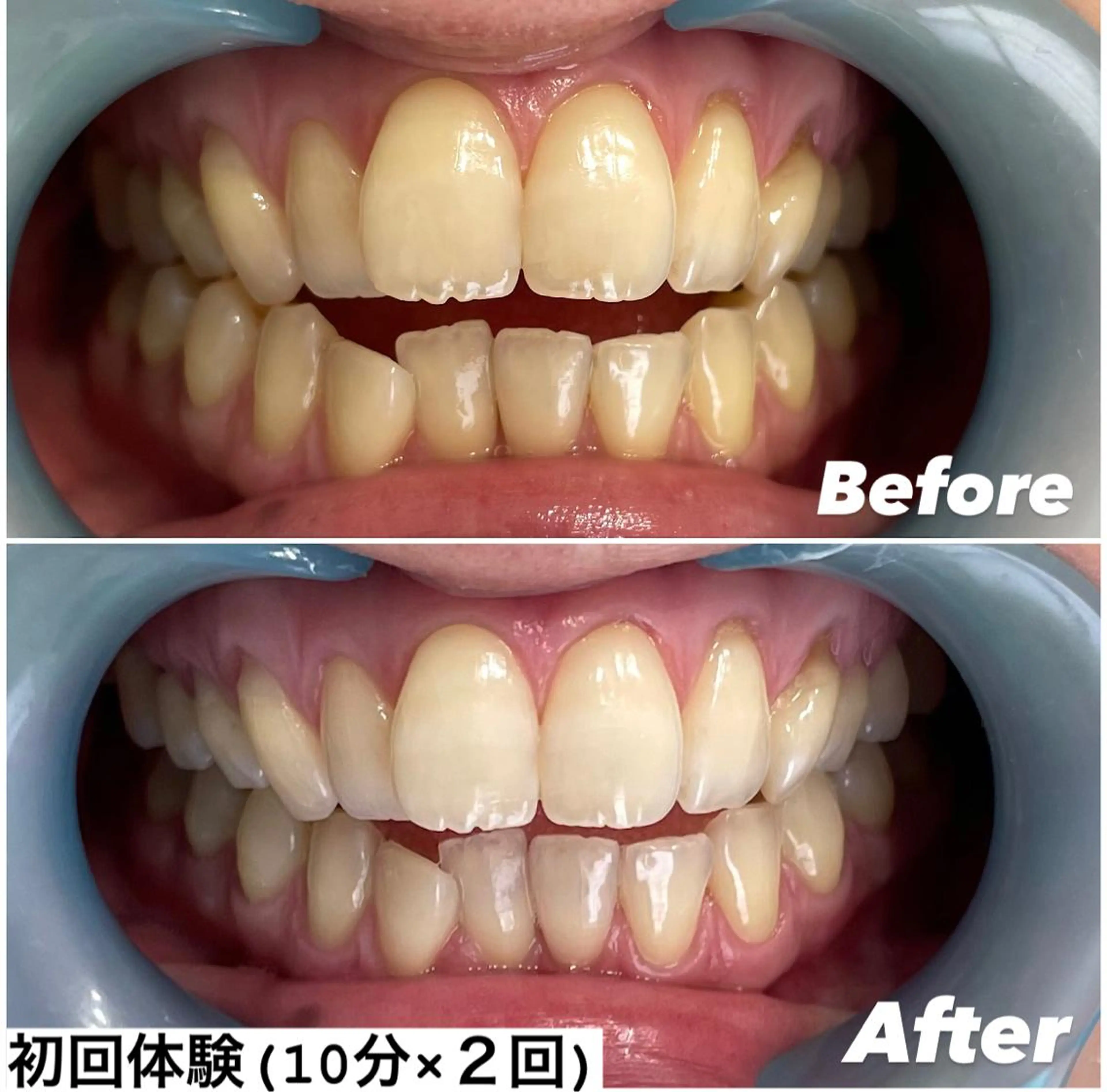 その他 ホワイトニング専門店 Hi-Whiteのその他イメージ