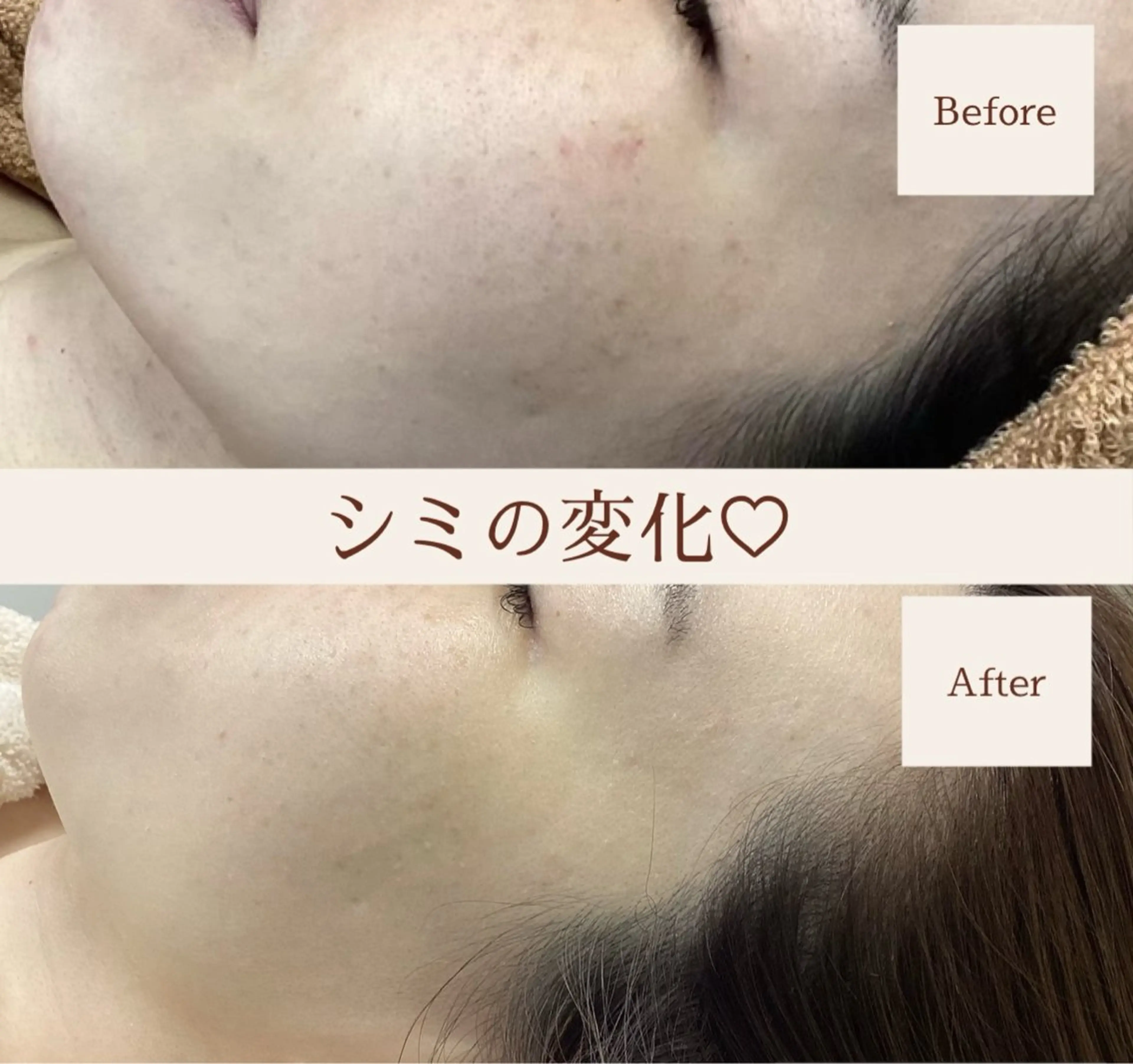 都度払い 肌質改善専門サロンのエステ・リラクイメージ