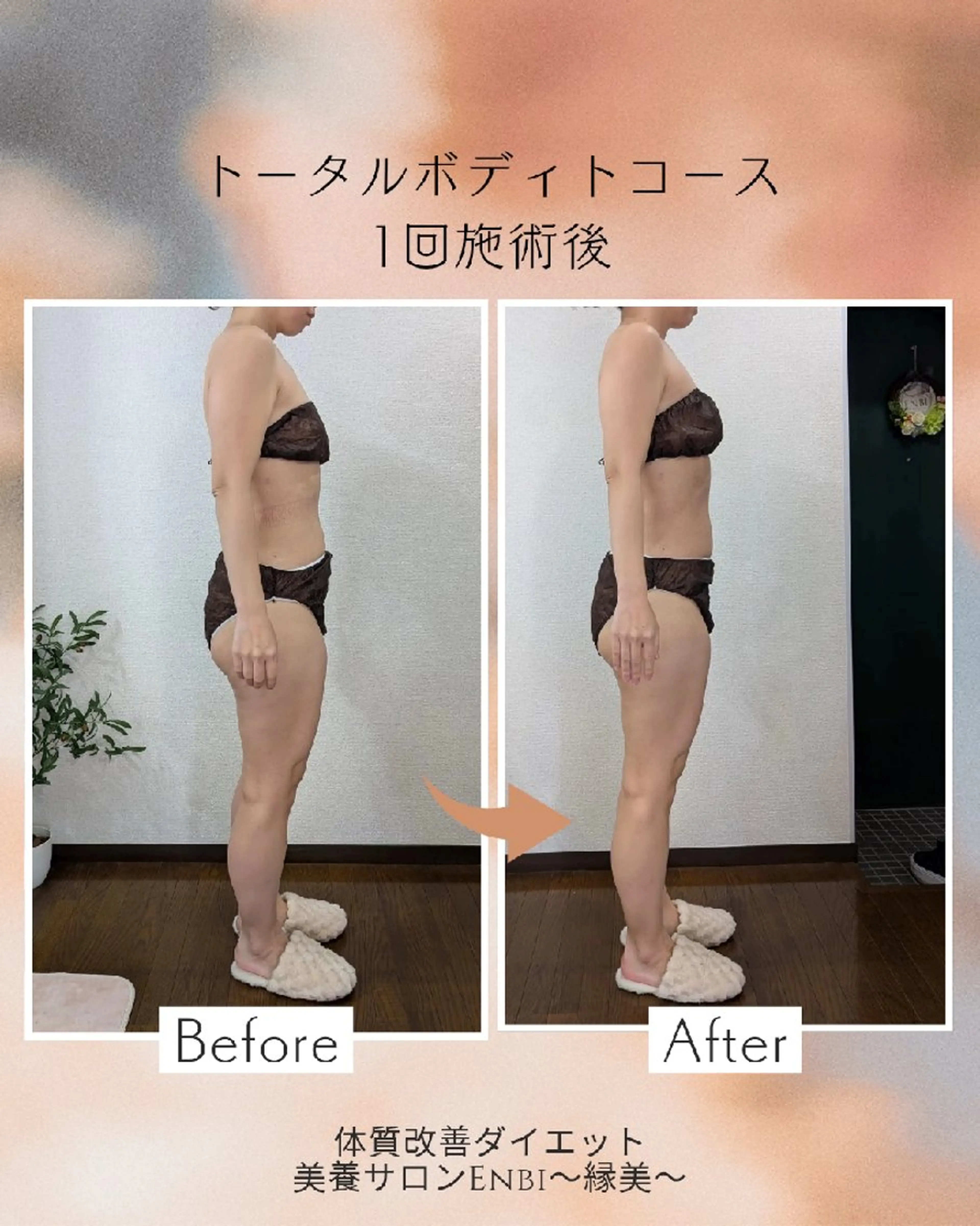 【痩身▪️体質改善ダイエット】美養サロンEnbi～縁美～所属・美養サロンEnbi ～縁美～のエステ・リラクイメージ