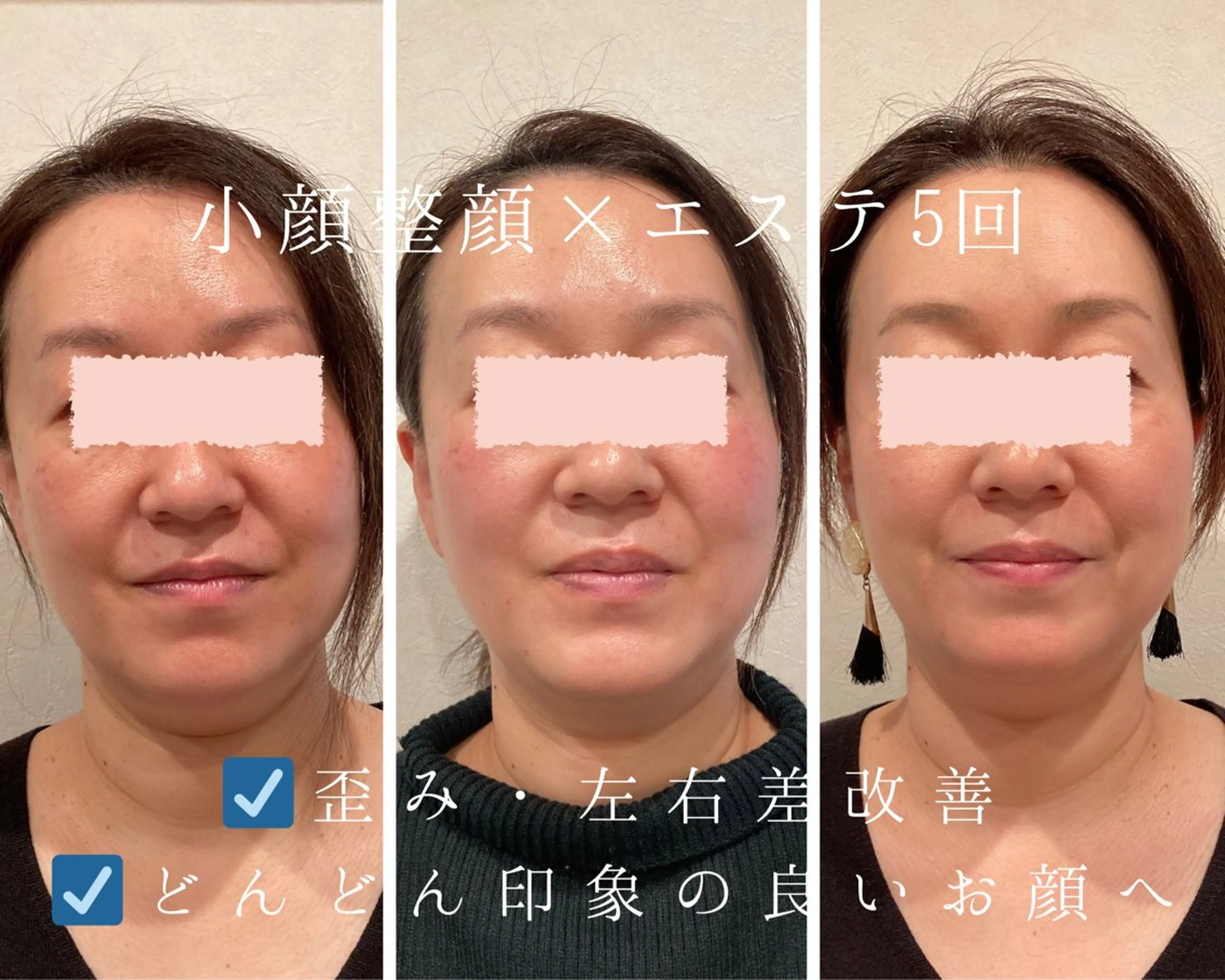 小顔×肌質改善サロン soin〔ソワン〕のエステ・リラクイメージ