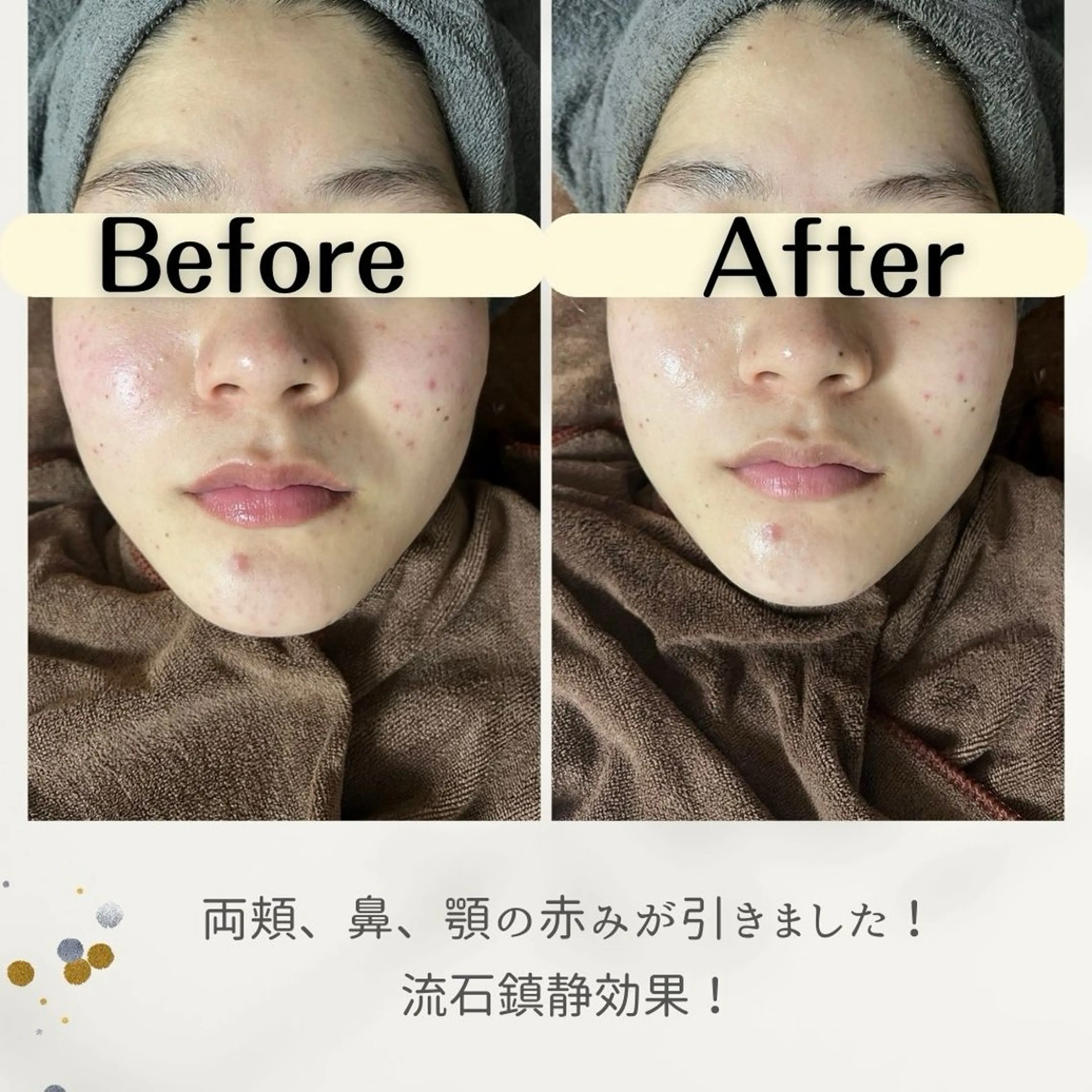 お肌と歯のサロン　Sona Mior所属・藤井 ののみのエステ・リラクイメージ