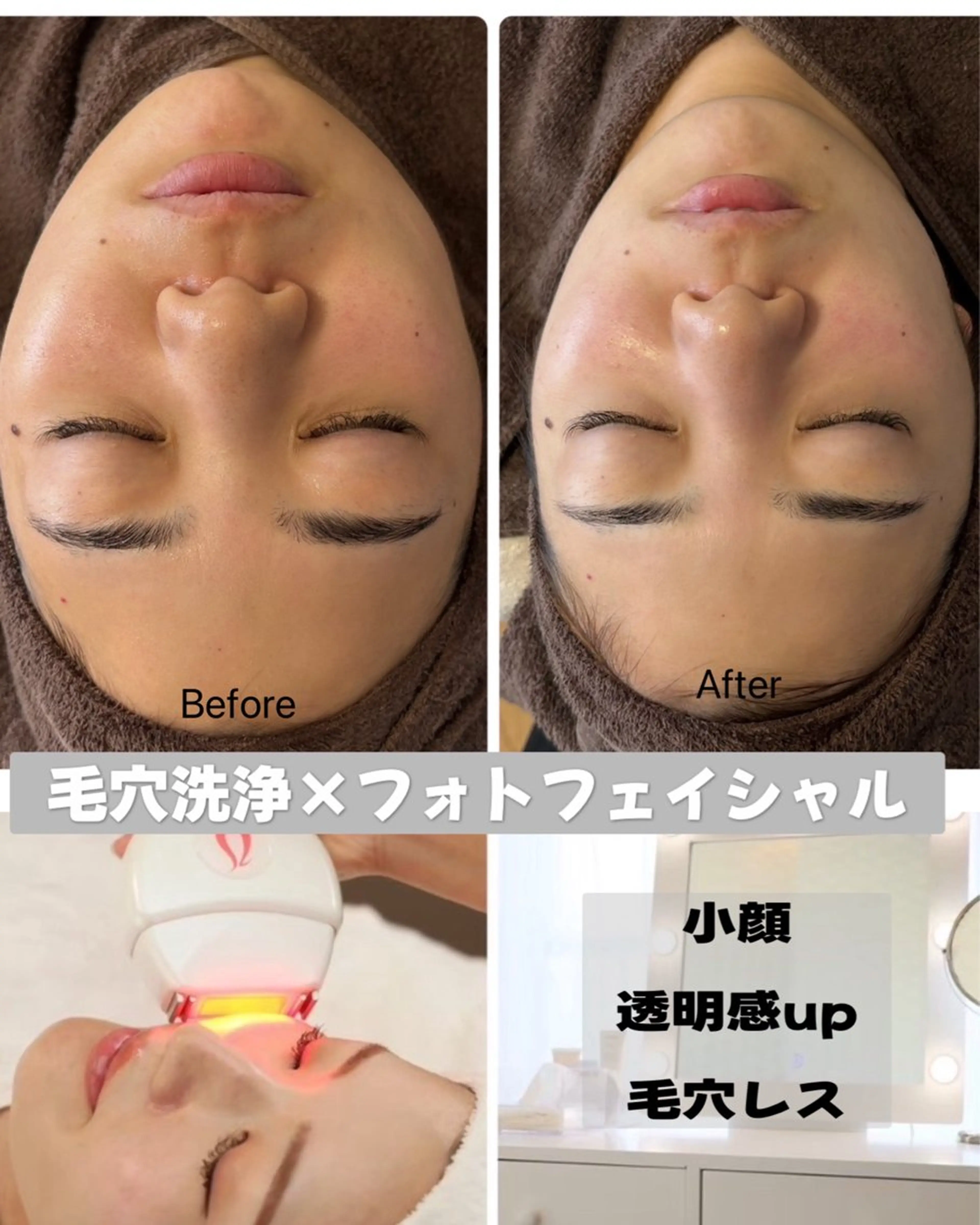 【卒業、入学シーズンぴったりコース◇】乾燥/黒ずみ/小顔もお任せ!毛穴レス肌!の写真