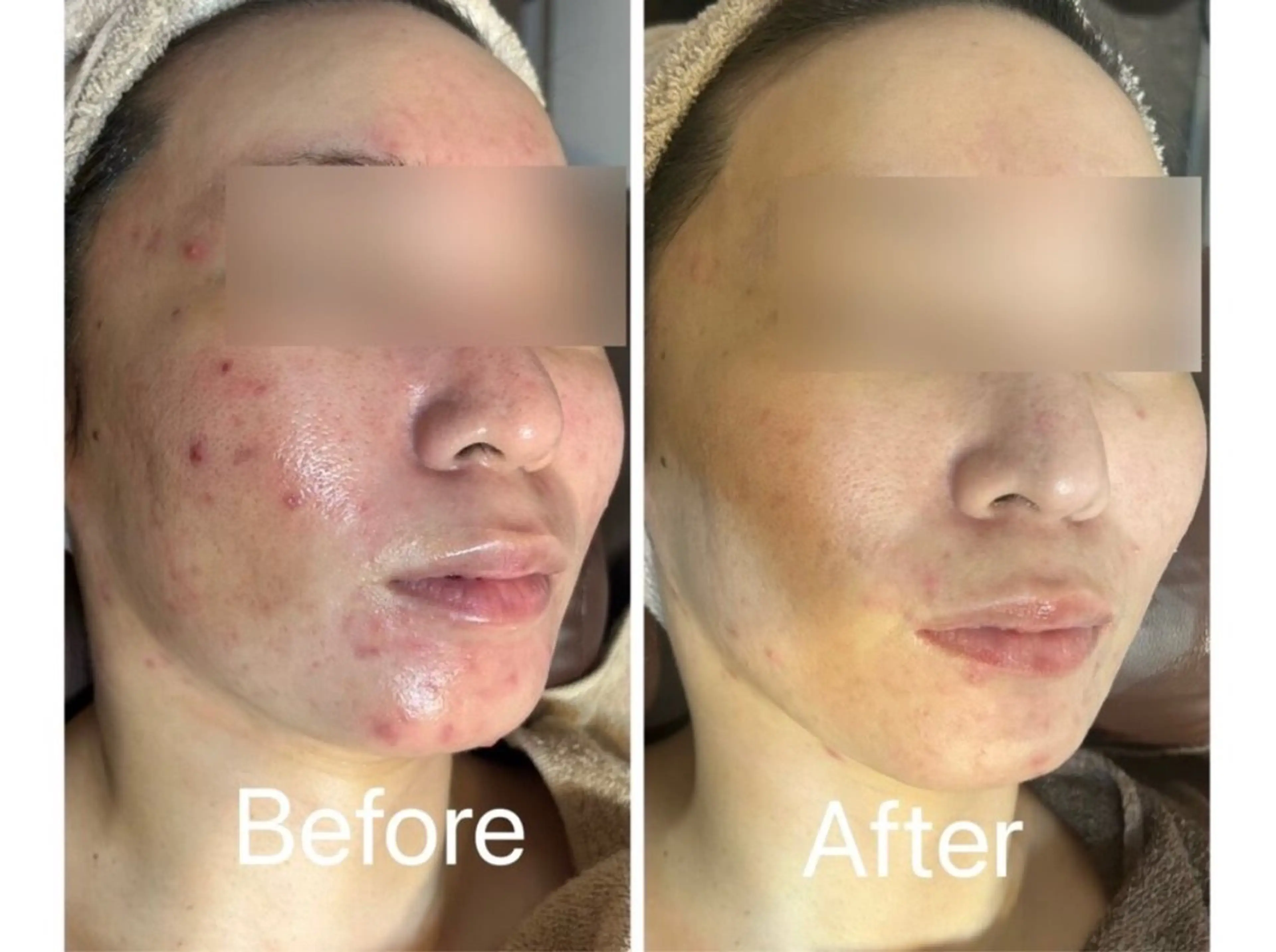 エステ Avenir Brillant所属・松田 紗季のエステ・リラクイメージ