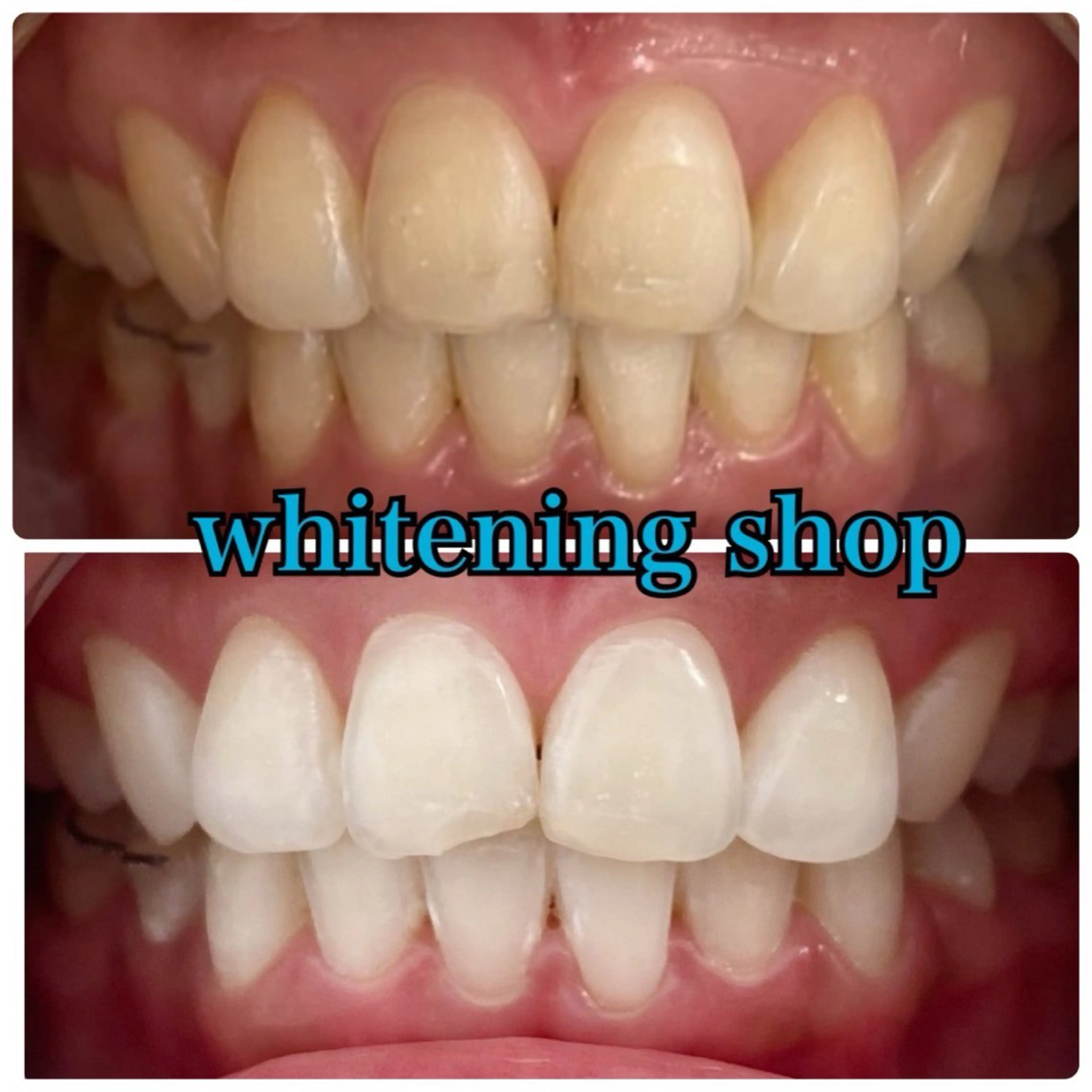 メンズ エステ リラク ホワイトニング ショップ川越店のエステ・リラクイメージ