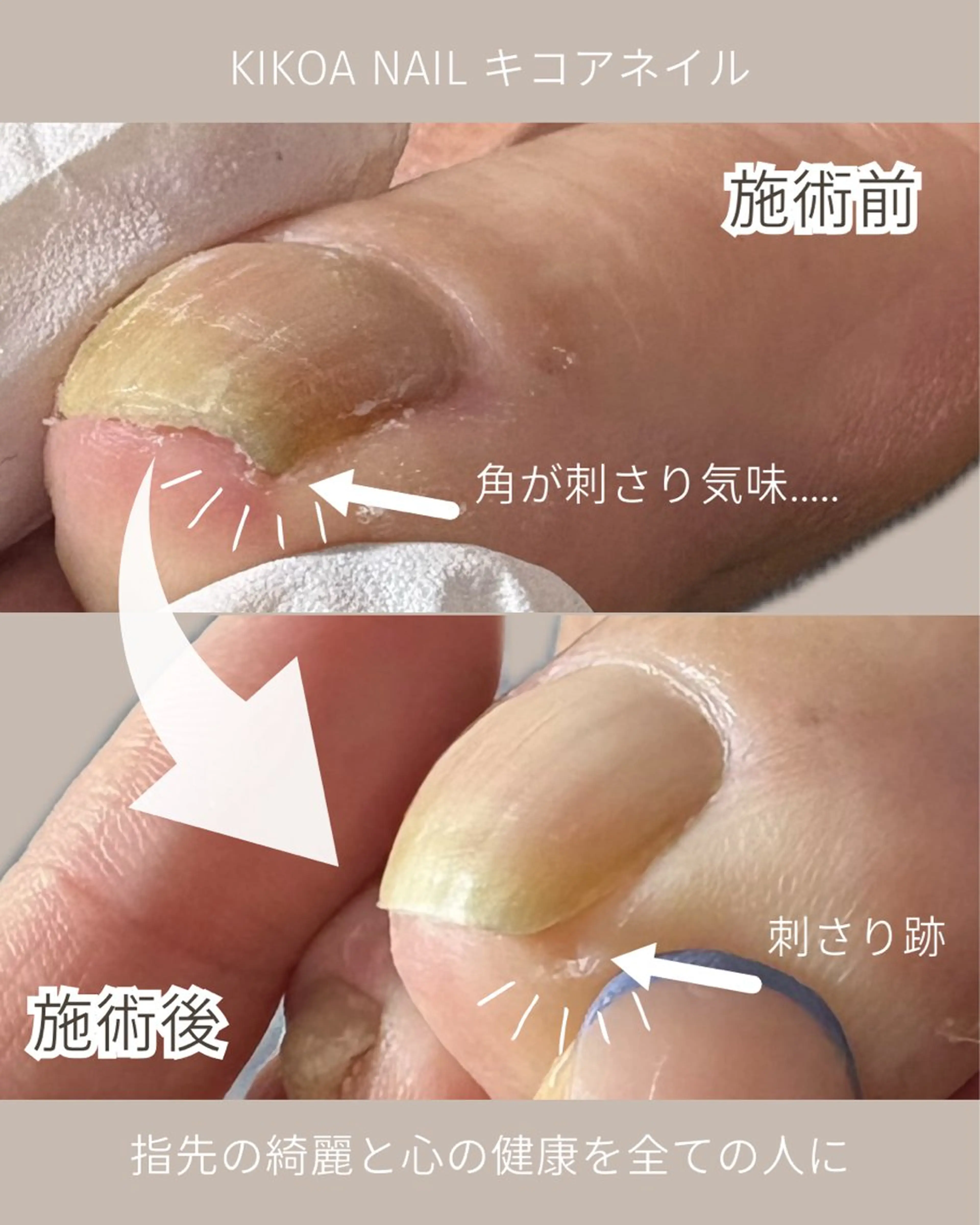 ネイル KIKOA NAIL キコアネイルのネイルデザイン